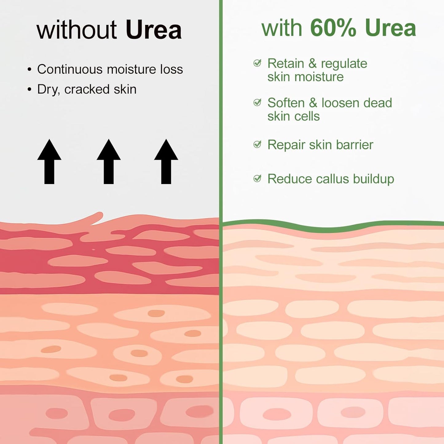 Urea Cream 60 Percent For Feet Maximum Strength Plus Salicylic Acid 2%, Tea Tree Foot Lotion For Dry Feetcracked Heels Treatment Athletes Foot Cream Intensive Repair Foot Moisturizer Care 5.29oz