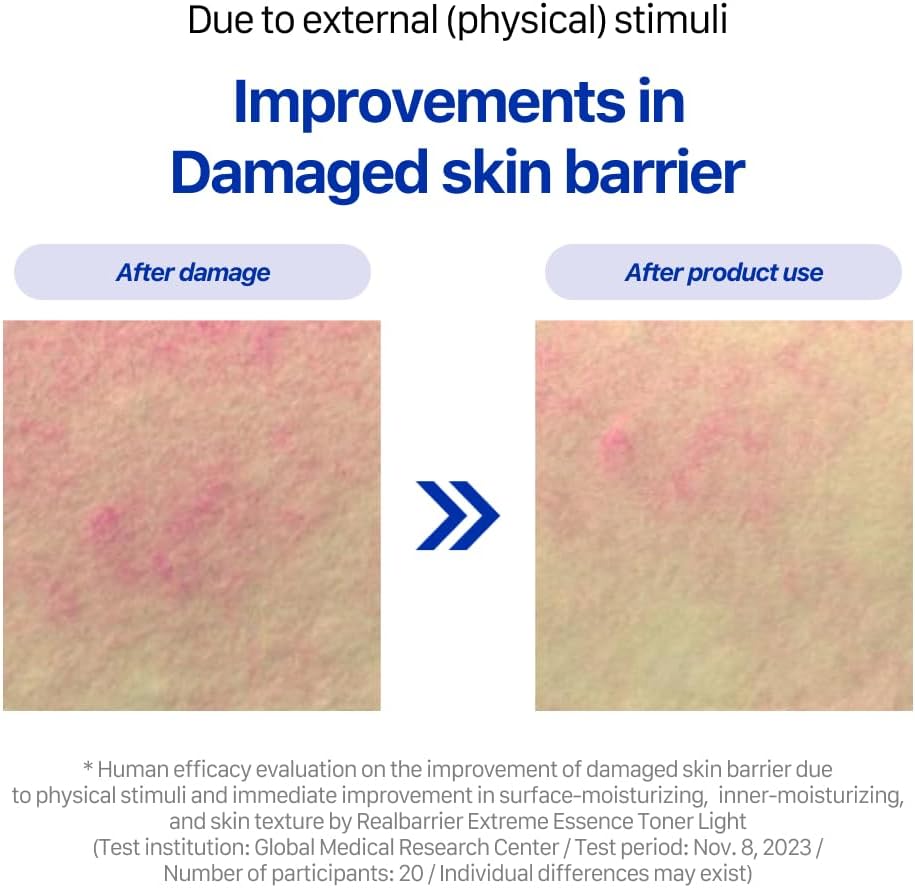 Real Barrier Extreme Essence Toner Light 6.76 Fl Oz | Hyaluronic Acid Panthenol Face Moisturizer for Sensitive Dry Skin | Soothing & Hydrating Moisturizing Toner for Face | Korean Skin Care