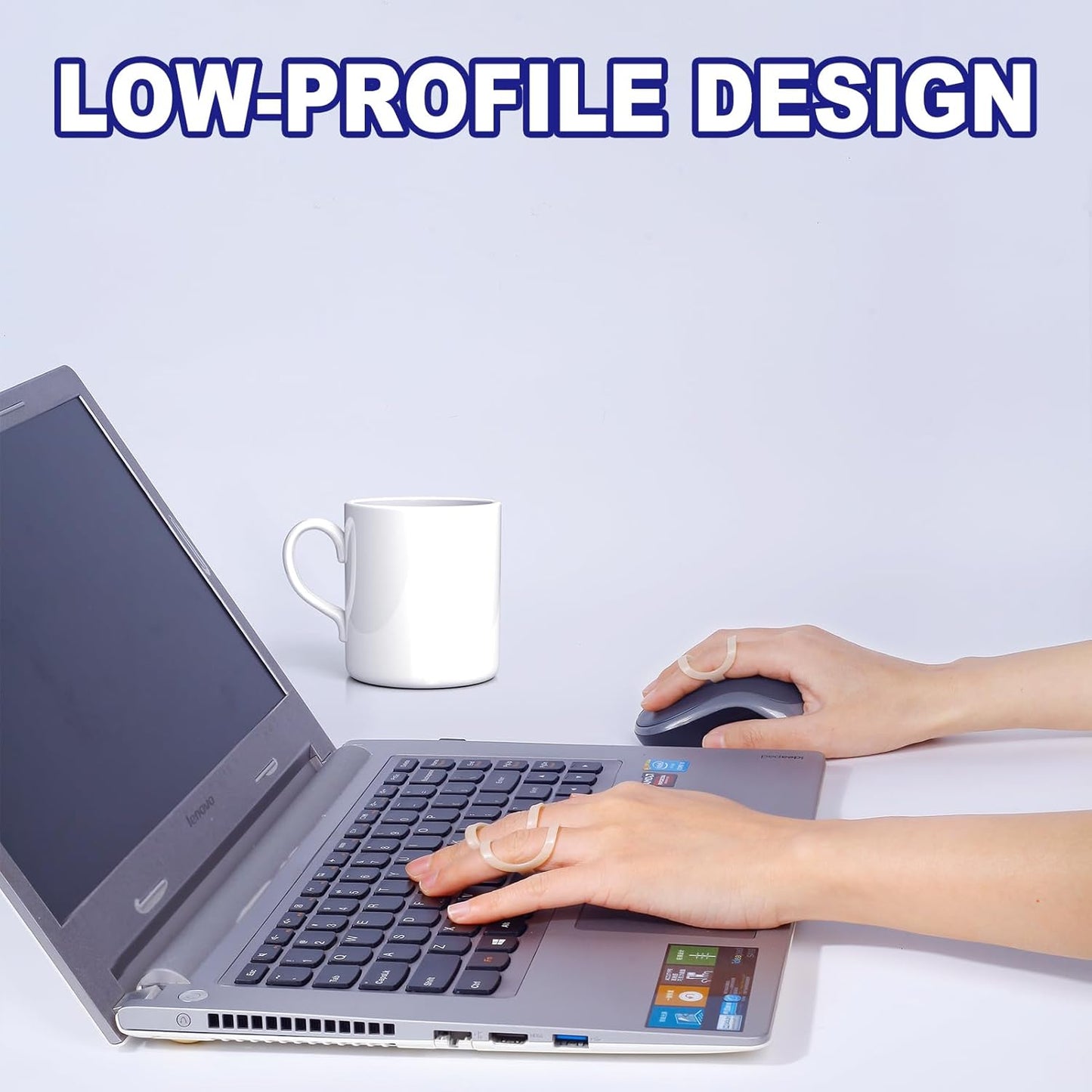 8Pcs Oval Finger Splints & Click-Lock Adjustment Kit, 4 Graduated Finger Ring Splint & 4 Splint Adjustment, Finger Braces for Arthritis, Mallet, Straightening, Support (Size 1-4)