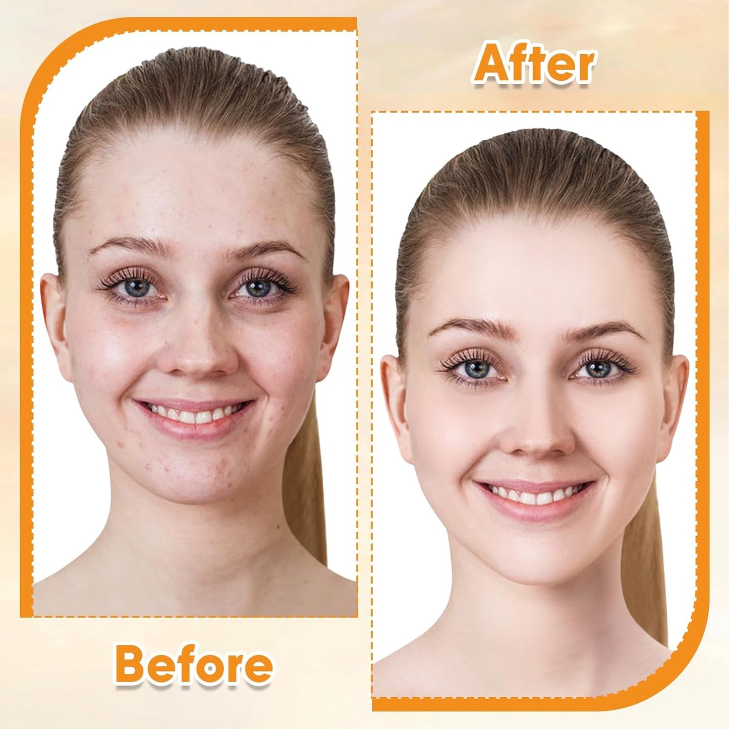 Vitamin E Rose Oil & Gua Sha Massage Tools Set, Gua Sha Oil for Face & Body, Organic Vitamin E Oil for Moisturizing and Hydrating, Anti Aging, Spa Gifts for Him Her