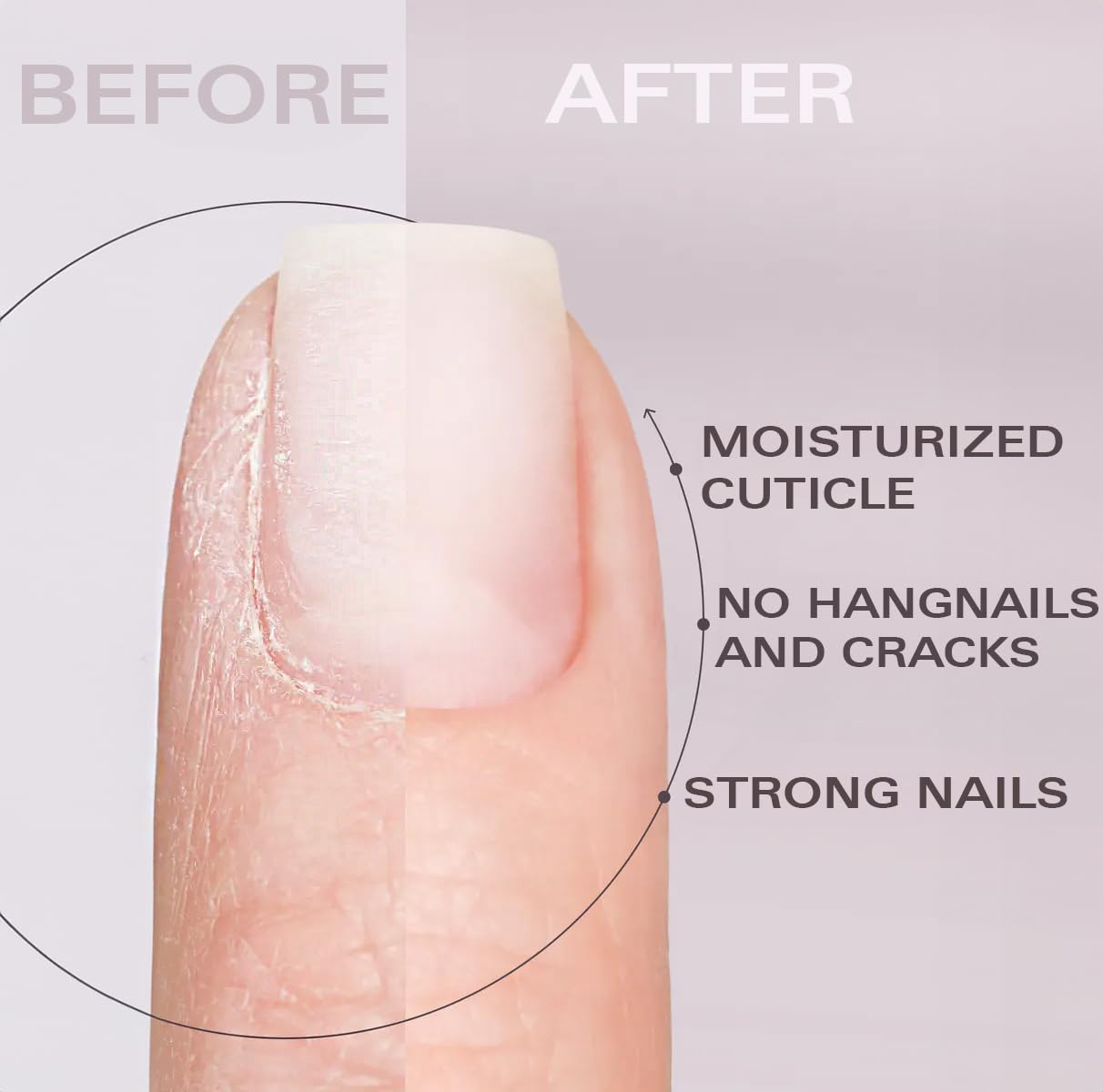 Cuticle Oil Pen - Strawberry Scent, Vitamin E Nail Strengthener and Growth Serum for Nail Care, Nourishing and Hydrating Formula for Healthier, Stronger Nails