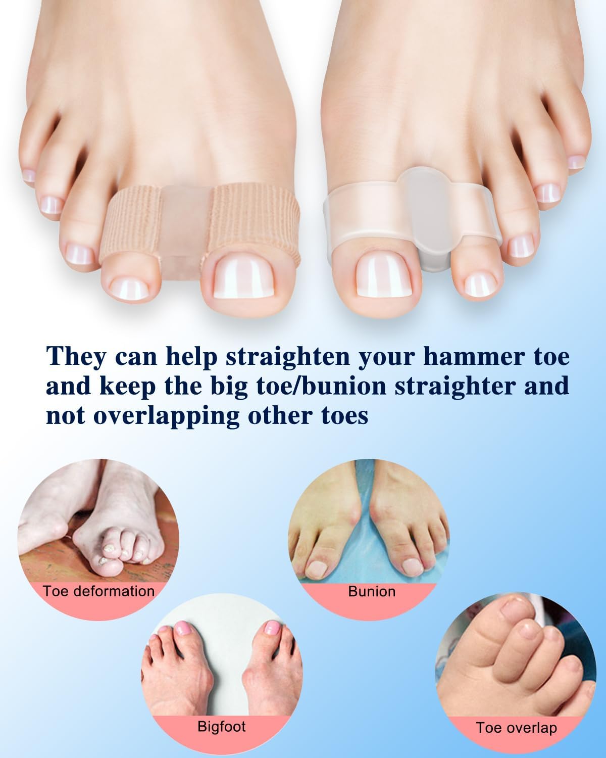 4Pcs Toe Separators for Bunion Correction, Big Toe Straightener Elasticity Hammer Bunion toe Corrector Spacers for Feet Women Men Correct, with 2 Loops (2 Nylon+2 Gel)