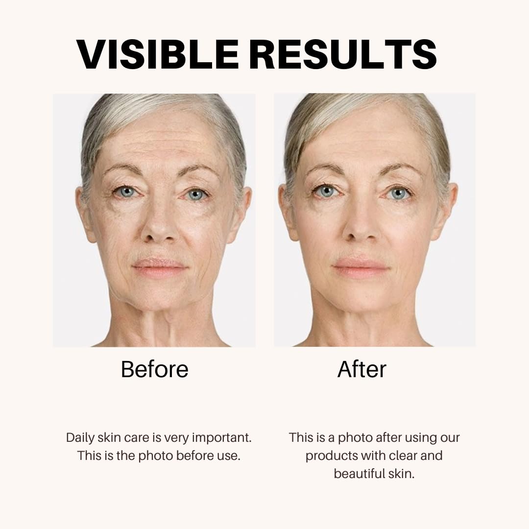 Anti-Aging Lifting & Firming Cream – Hydrating & Tightening Formula for All Skin Types – Paraben-Free, Fragrance-Free, BHA-Free (1.7 fl oz / 50 ml)