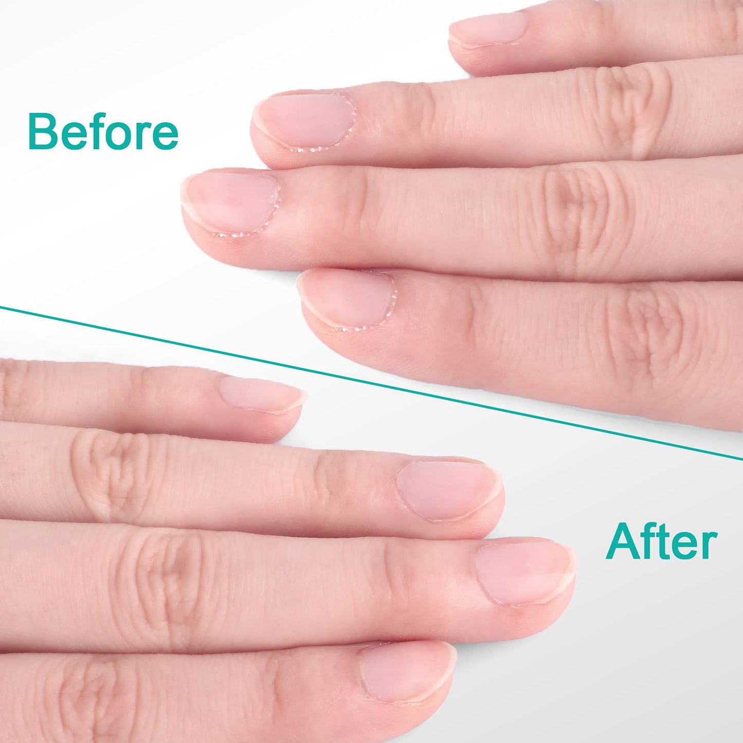 Easkep Cuticle Trimmer with Cuticle Pusher, Professional Cuticle Remover Sturdy Pedicure and Manicure Tool for Healthy Nails (D501-Green)