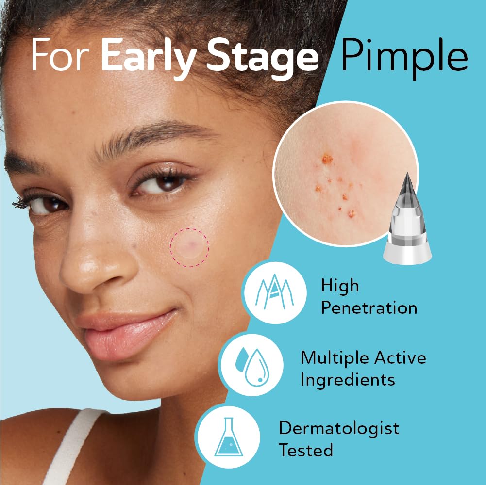 Microdart Acne Patches for Deep Blemishes - 18 Pimple Patches - Hydrocolloid Pimple Patch with Salicylic Acid, Azelaic Acid, CICA & Vitamin C - Targets Stubborn Blemishes Dark Spots & Cystic Acne
