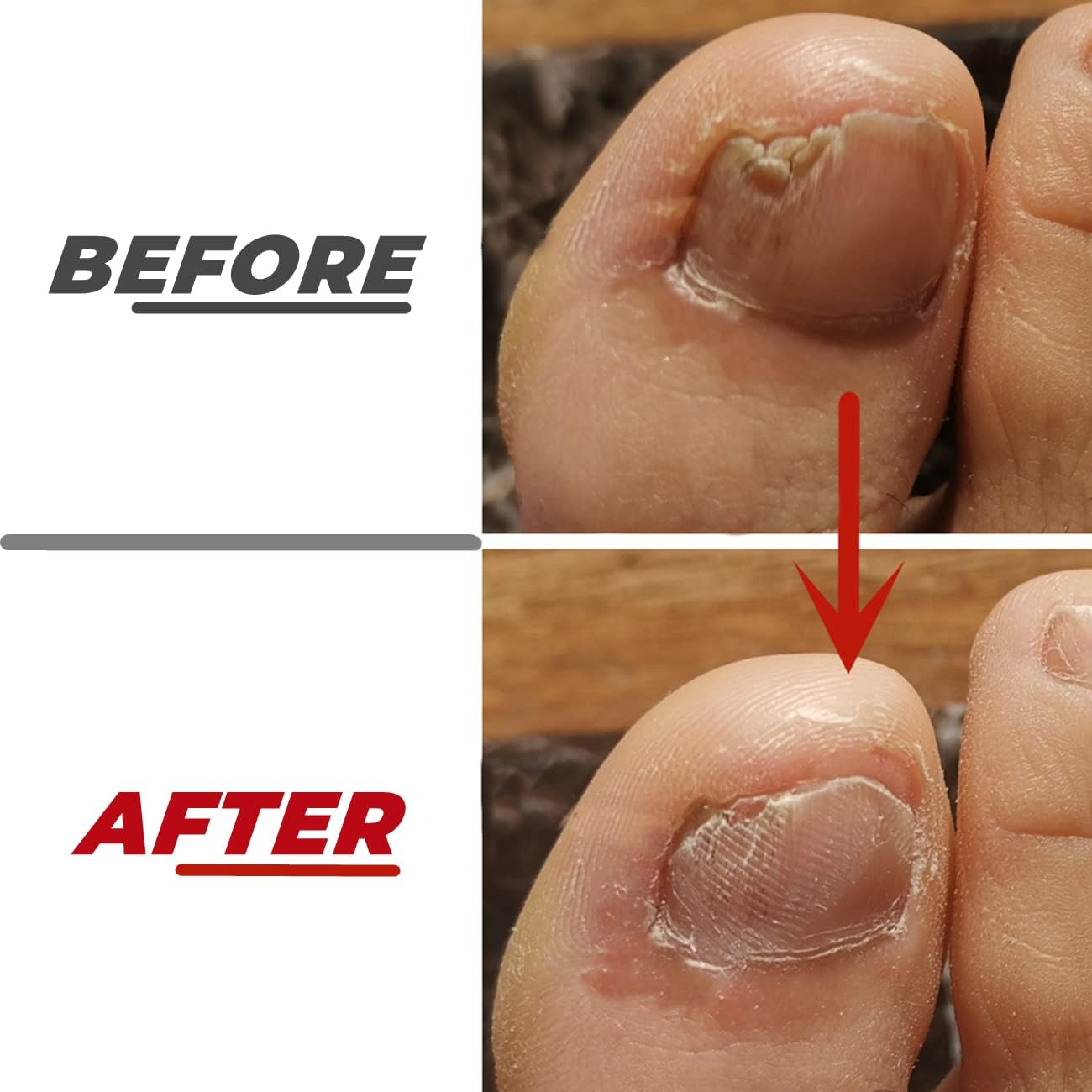 2 Pieces Toe Nail Files for Thick Nails,Stainless Steel, 4 Sides for Men Seniors & Dogs