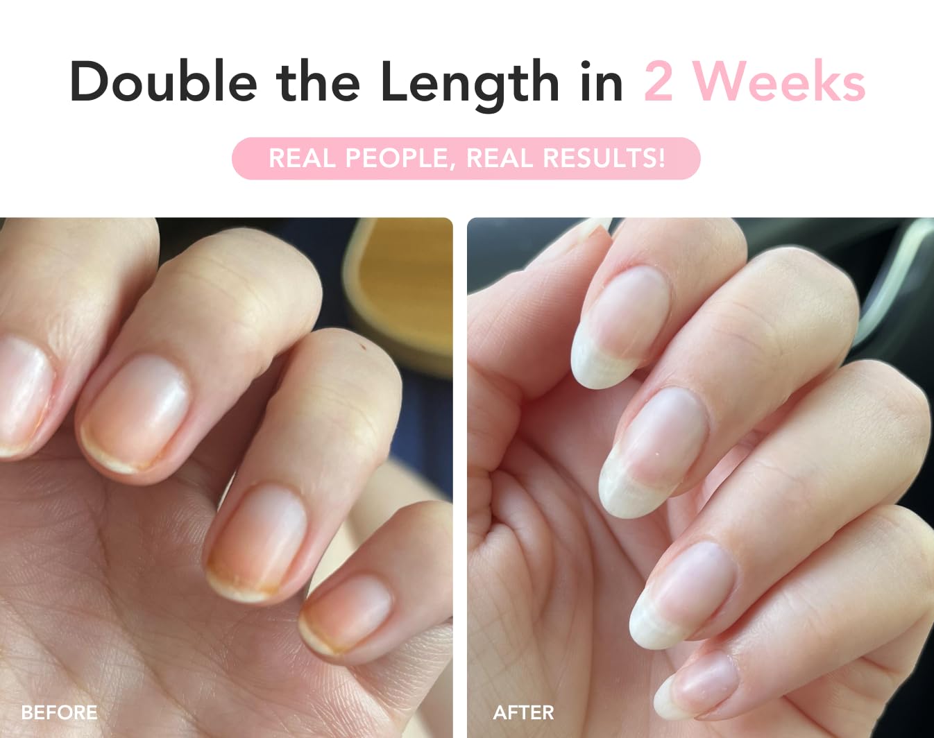 Liaison UltraGrow Nail Serum for Growth and Strength with Keratin Complex, Olive Oil & Vitamin E | Dermatologist-Tested to Support Weak, Brittle, Splitting Nails