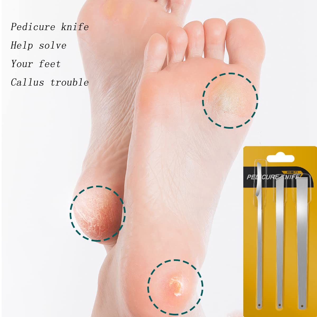 Stainless steel ingrown toenail pedicure knife set,professional foot skin scraper repair sharp blade kit for nail corn callus paronychia treatment. (3)