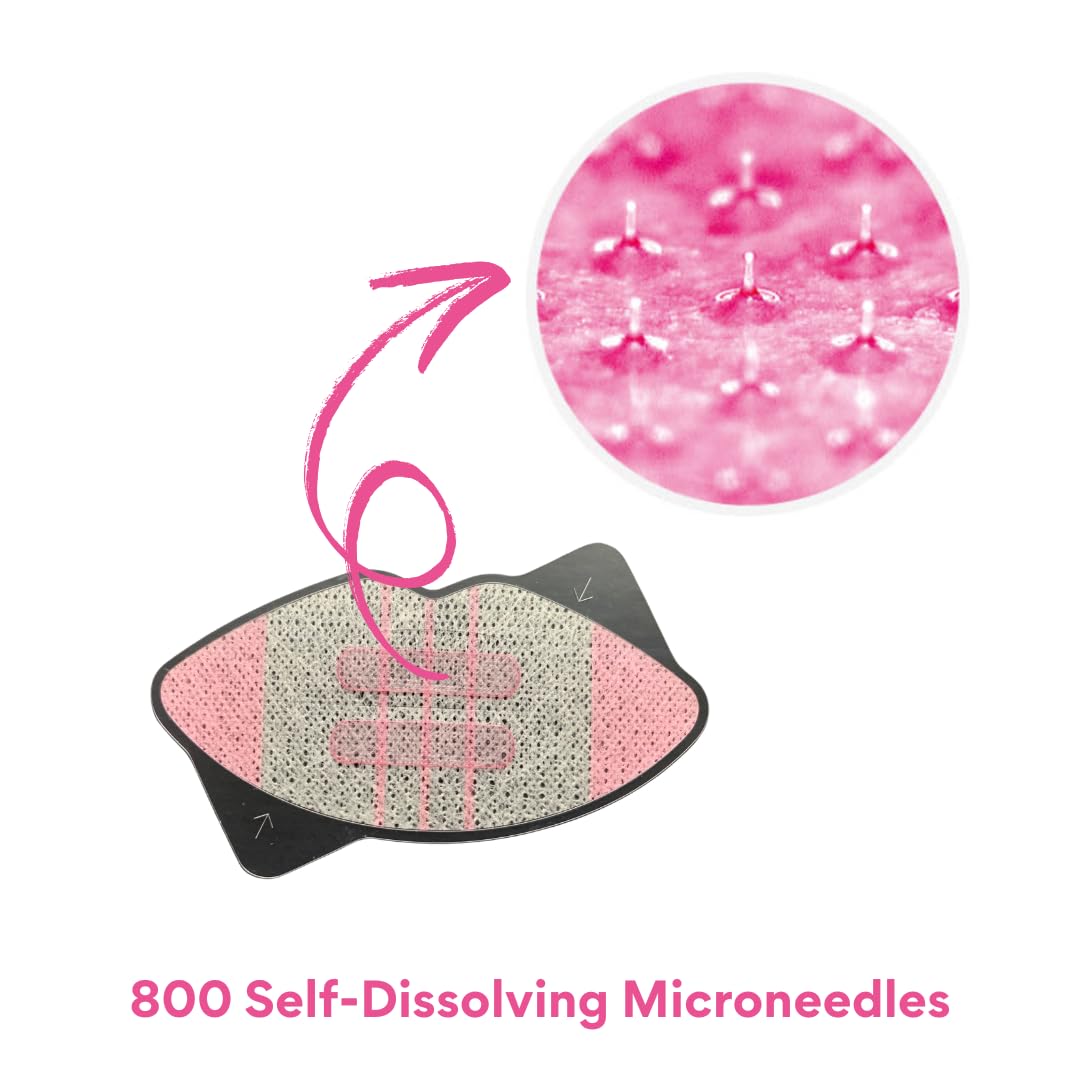 HyaluPlump Lips – Innovative Two-Step Lip Care System Featuring 800 Self-Dissolving Microneedles made from Sodium Hyaluronate, Niacinamide, and Peptides for Hydrated, Plump Lips