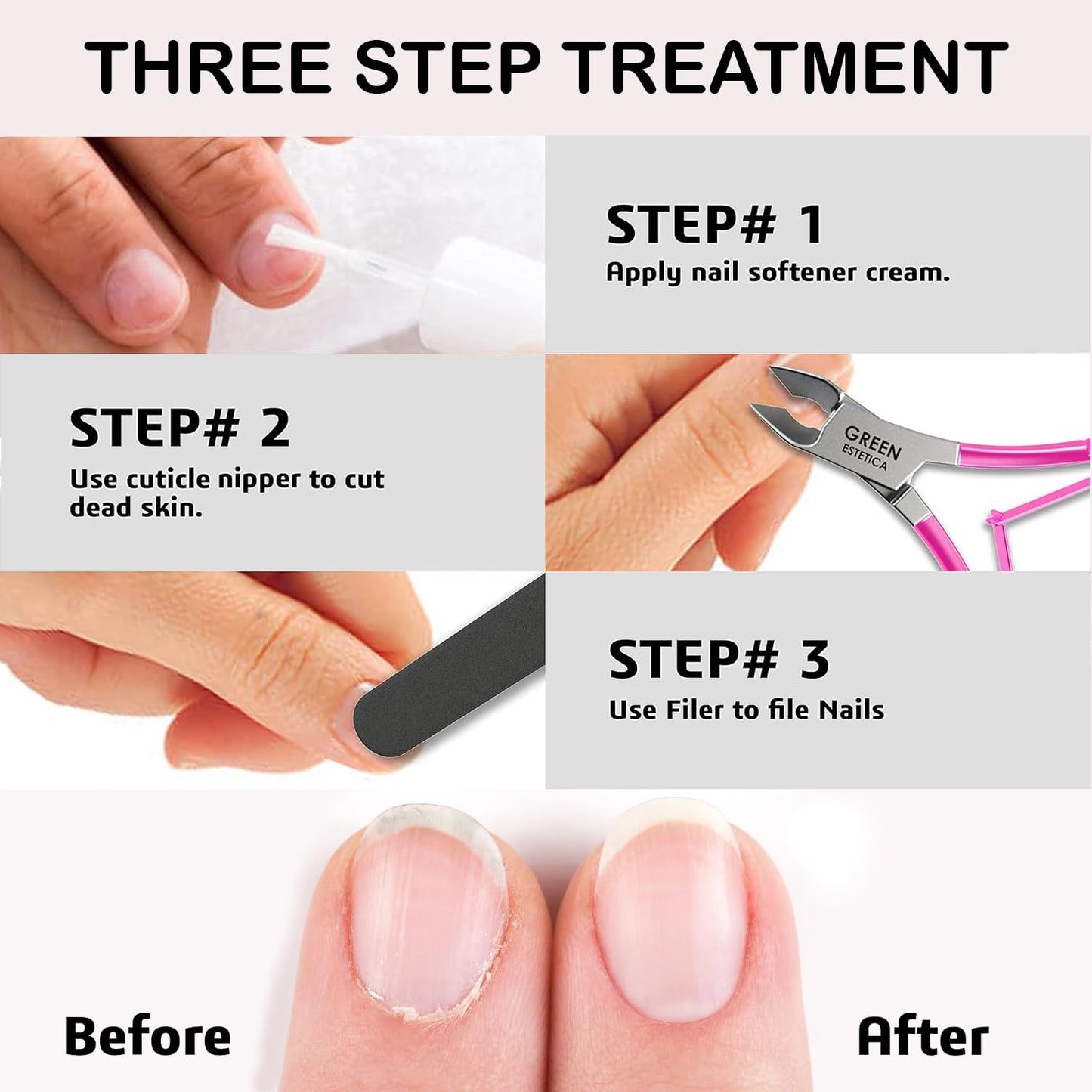 Professional Cuticle Trimmer Nail Cuticle Cutter Stainless Steel Cuticle Nippers with Sharp Blades of Cuticle Remover Clippers Manicure Tools Double Spring for Nail Care Pedicure Nail Tools (Pink)