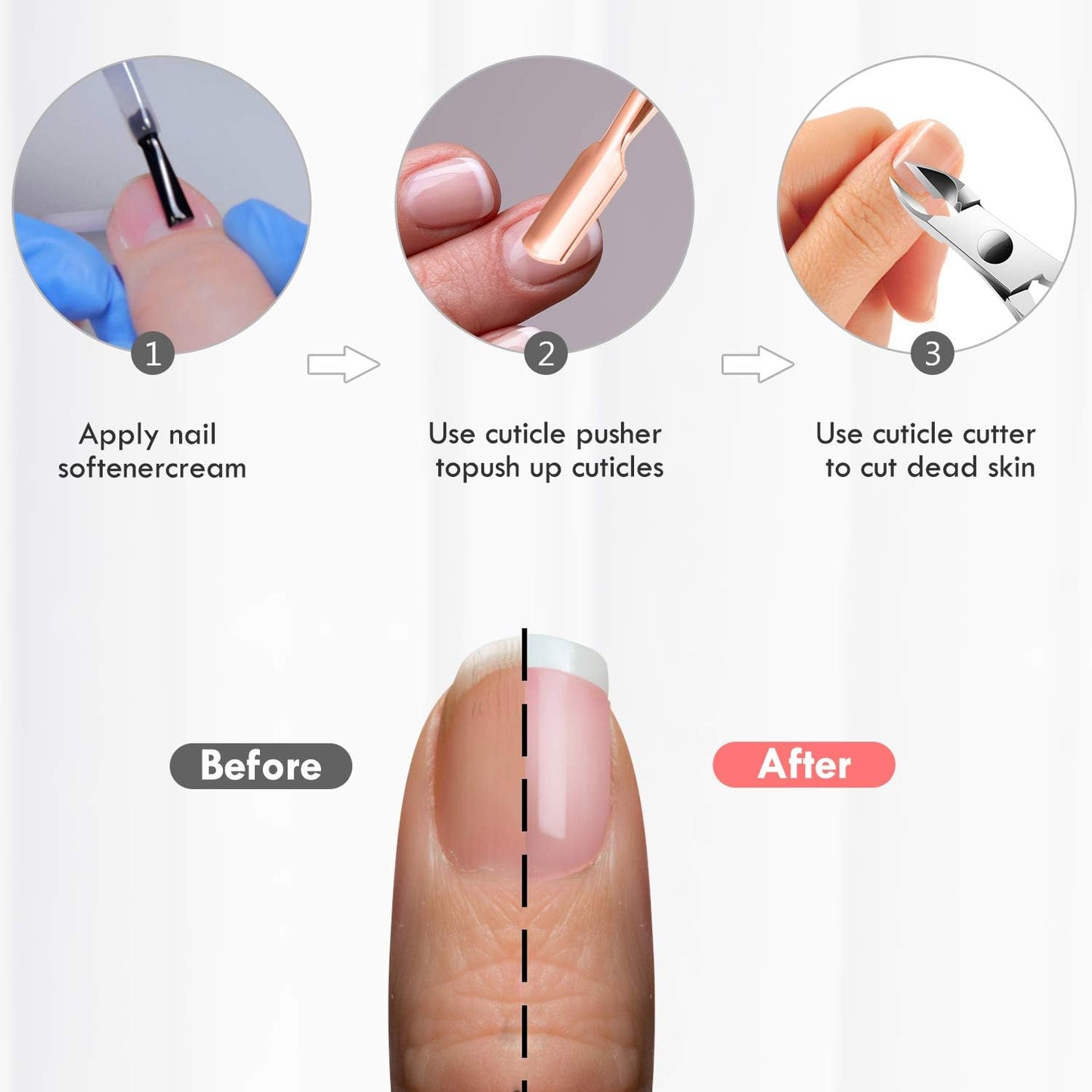 Cuticle Trimmer Cuticle Remover with Cuticle Pusher, XUNXMAS Professional Stainless Steel Durable Pedicure Manicure Tools Cutter Nipper Scissor Clipper for Fingernails and Toenails Rose Gold