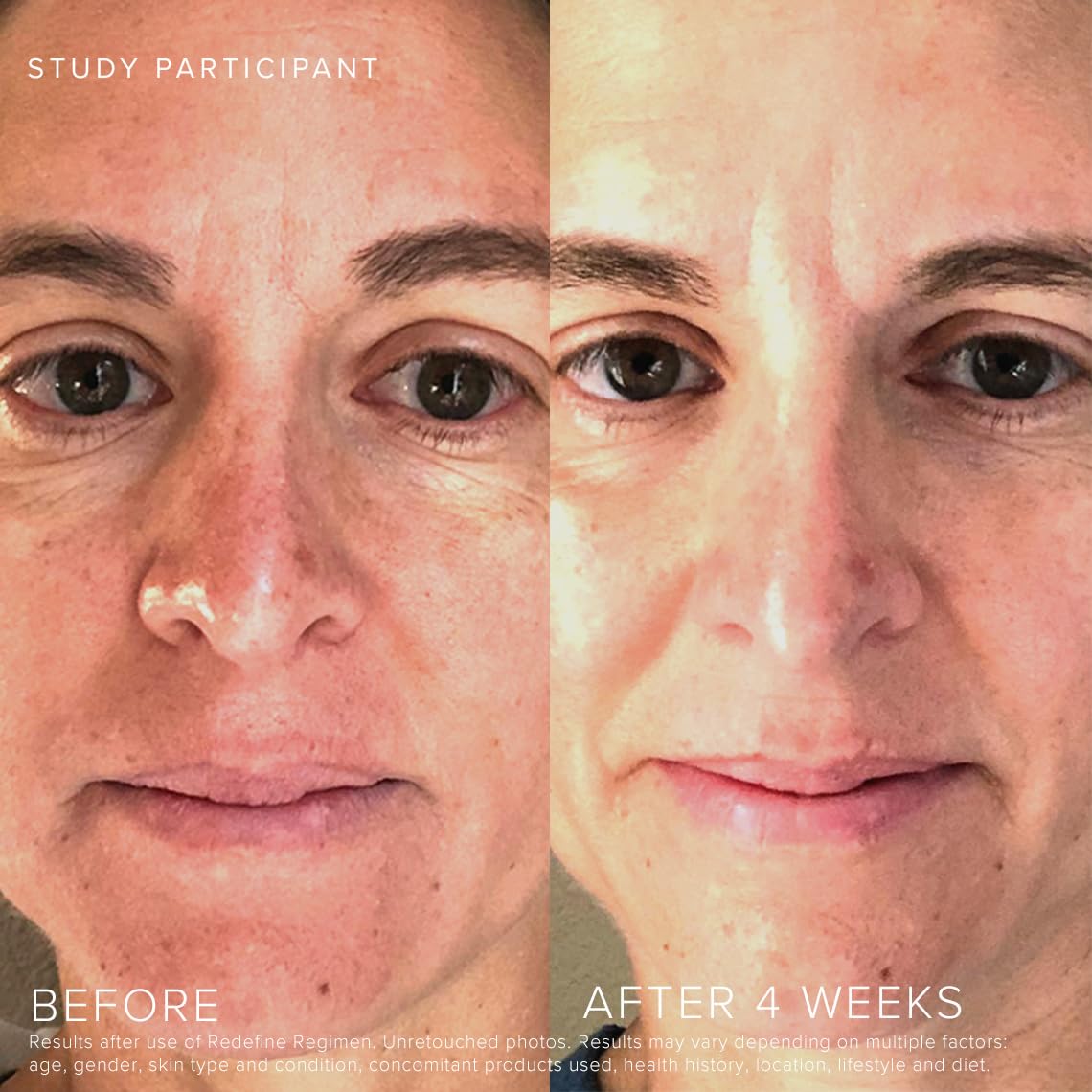 RODAN + FIELDS Redefine Daily Foaming Cleanser | 125 mL | Gently Exfoliating Skin Care | Face Wash & Makeup Remover | Deep Cleansing with Anti Aging Properties