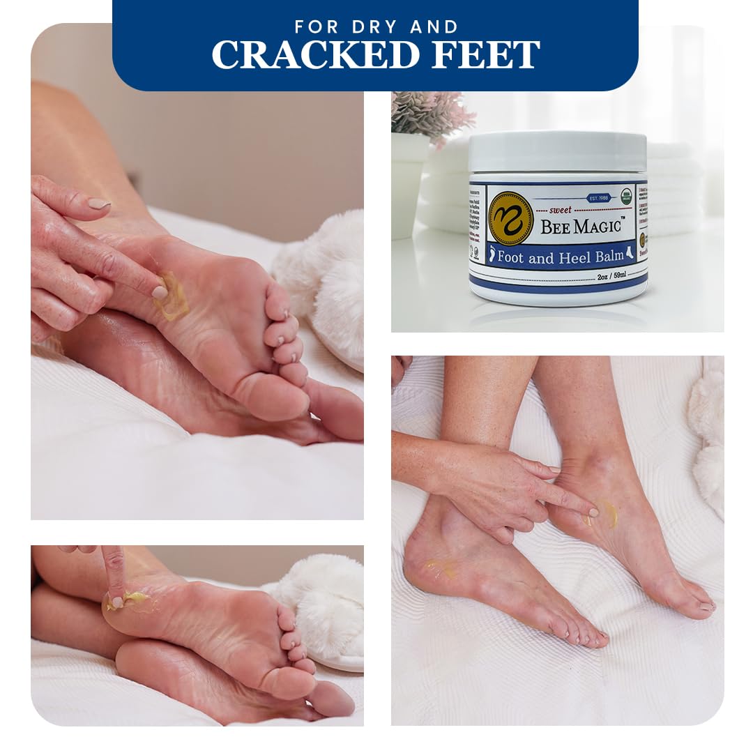 Sweet Bee Naturals Organic All Natural Foot and Heel Balm 3 (2 OZ Jars). For Dry and Cracked Feet Repair. Organic Salve Moisturizer for Heel Care & Callus Treatment. Made in USA. 3 Jars (6 OZ)