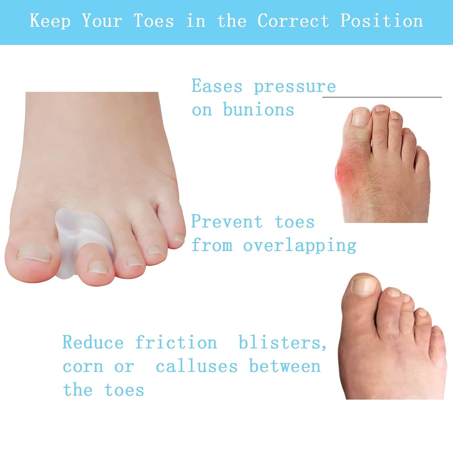 Pack of 12 Gel Toe Separator, (1/4" Thick) Big Toe Spacers, Single Loop Toe Spreader for Bunions, Overlapping Toe, Corrector and Spacer (Clear)