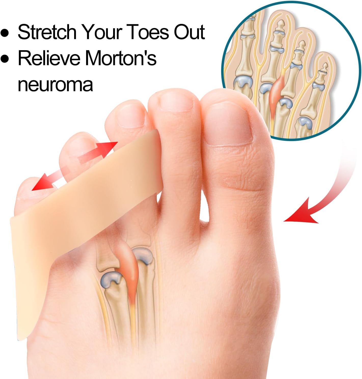 Povihome 10 Pack Pinky Toe Separator and Protectors for Overlapping Toe, Curled Pinky Toes - Spacers for Morton's Neuroma Pain Relief, Firm Support, Beige