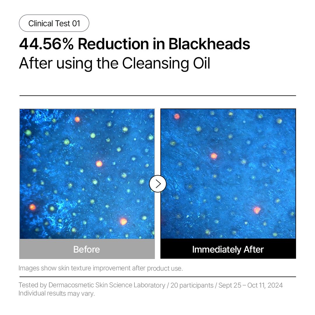 Parnell Aha Omija Ceramic Cleansing Oil 200ml / 6.76 fl.oz | blackhead melting, korean facial cleanser, korean skincare