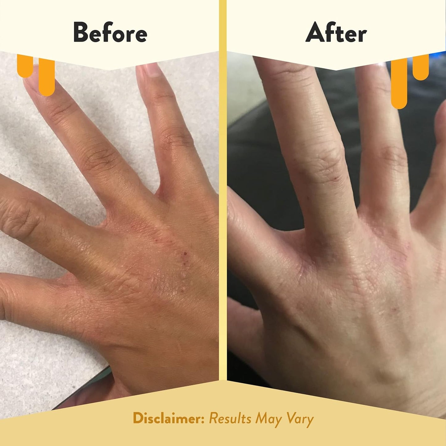 ECZEMA HONEY Premium Witch Hazel & Aloe Spray - Facial Mist Skin Care Product - Unscented Moisturizer, Dewy Makeup Spray, Aftershave & More (8 Oz)