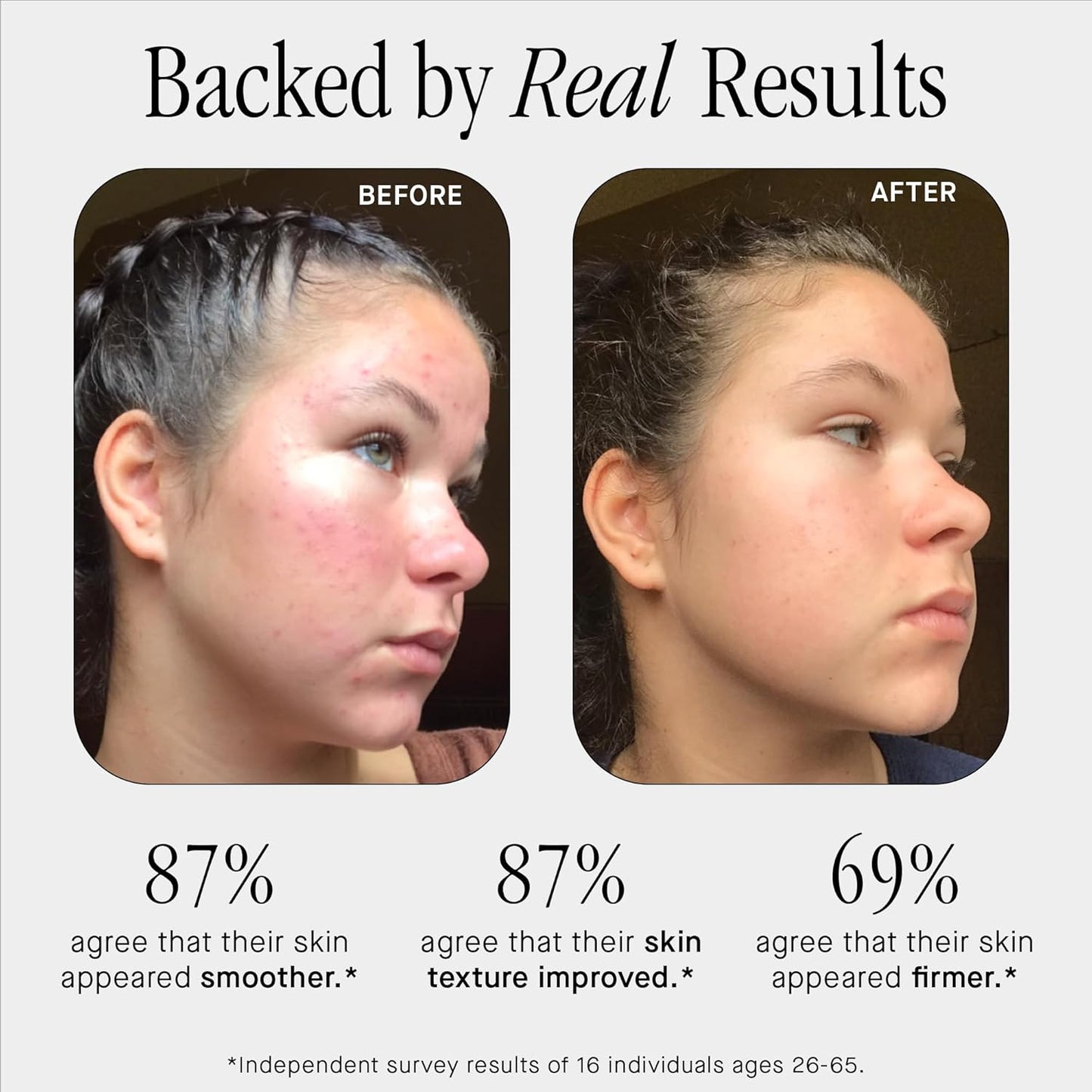 Brandefy No Needles - Niacinamide Serum, Peptides and Hyaluronic Acid. Hydrating & Plumping Serum for Bright, Smooth, Firm & Dewy Skin, 1oz, Made In The US