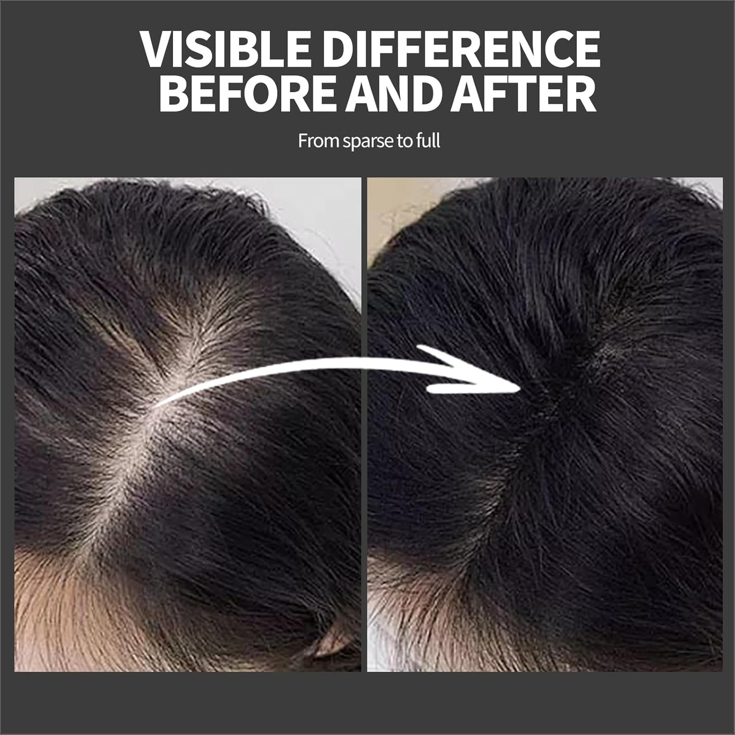 Hair Building Fibers 25G with Precision Spray Applicator - Electrostatic Adsorption for Instant Thicker Hair, Waterproof & Natural Look, Suitable for Men & Women (Black)