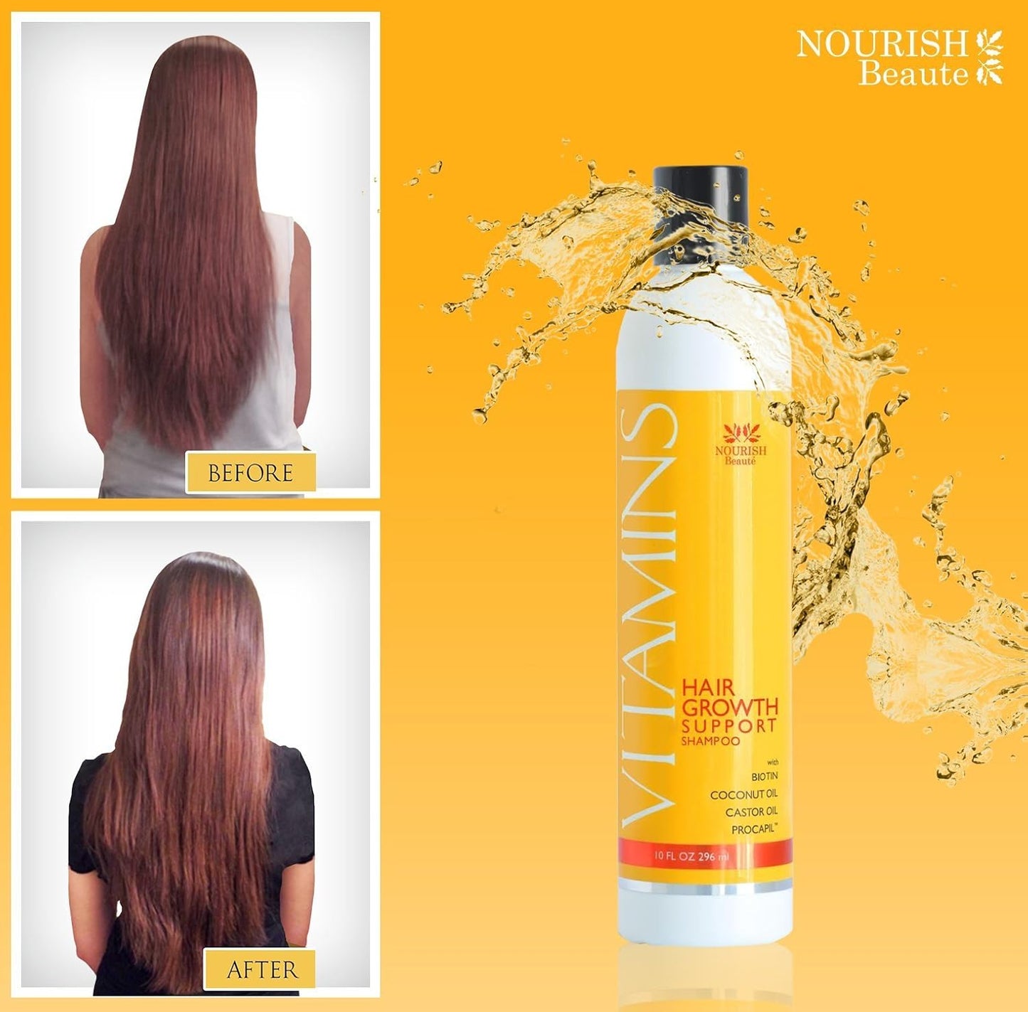 Nourish Beaute Vitamins Shampoo and Conditioner for Hair Loss that Promotes Hair Regrowth, For Men and Women, 4 Pack, 10 Ounces, Each