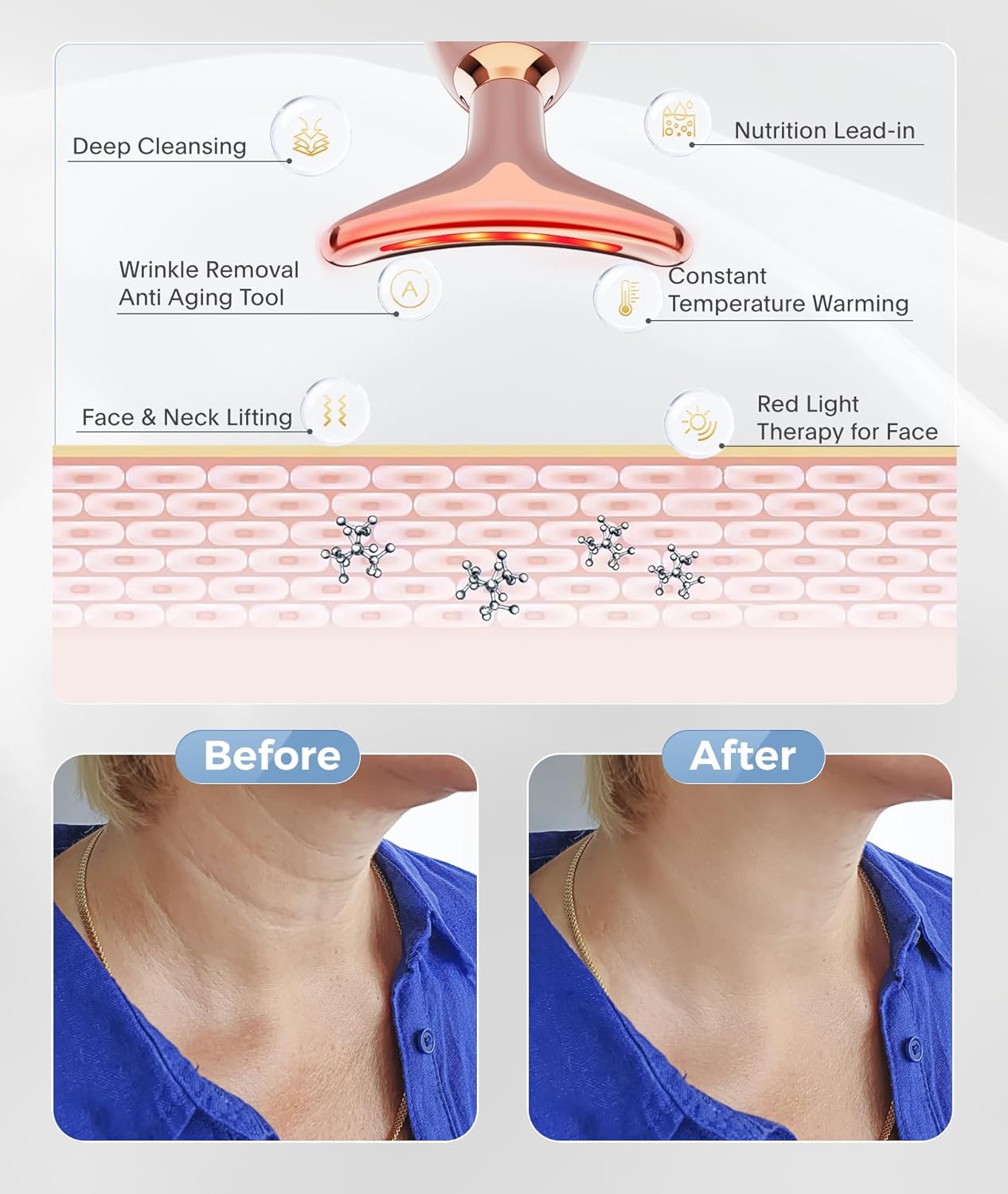 Light Based Face-Neck-Massager - 7 Color Portable Facial Massager for Skin Care, Rose Gold