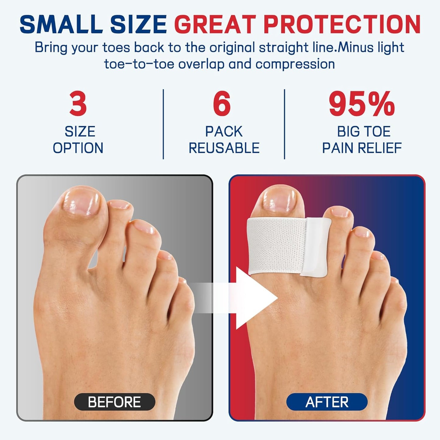 Big Toe Spacers,Hallux Valgus Corrector,Relieve Bunion Pain,Prevent Overlapping Toes, All-Day Comfort for Men & Women, Fits in Shoes.