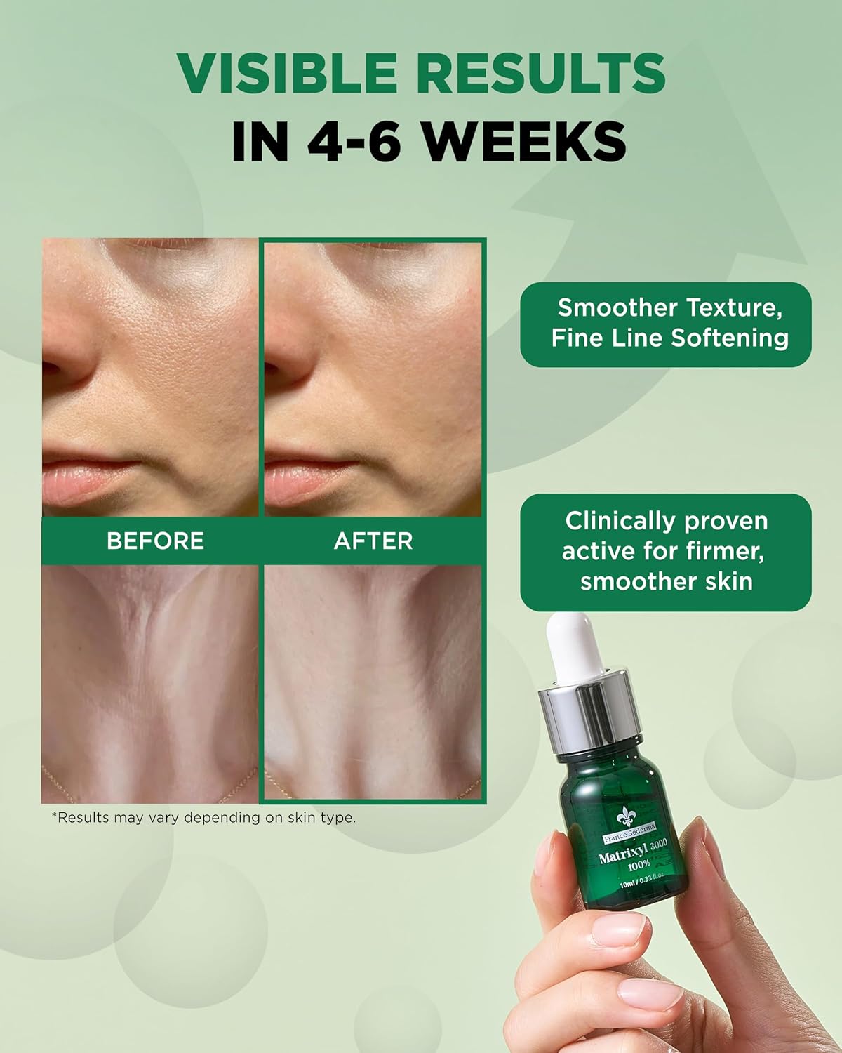 Matrixyl 3000 100% Serum Skincare – Pure Peptide Complex Anti-Aging Facial Ampoule from France Sederma, Collagen Boosting Wrinkle Treatment, Perfect for Layering & DIY, 0.33 fl.oz (10ml)