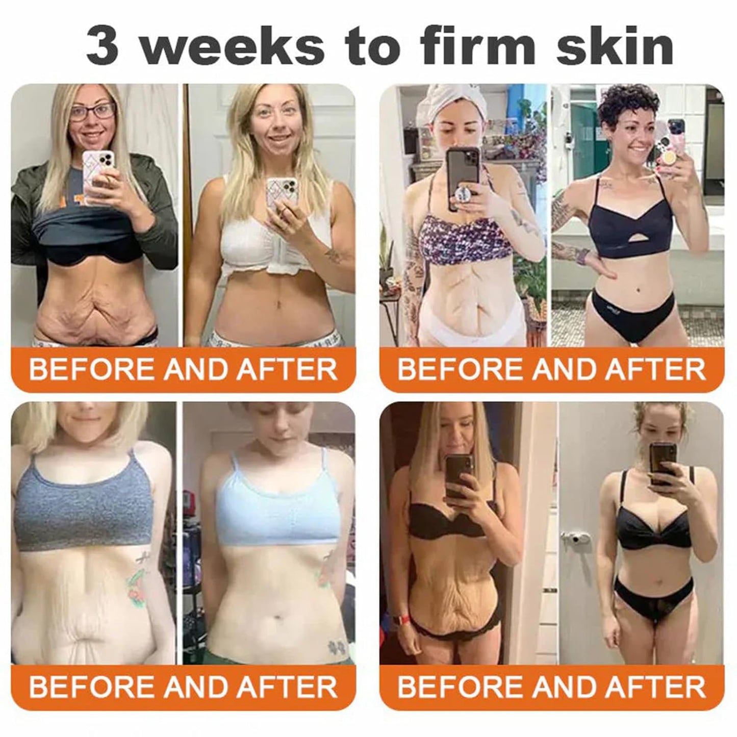 Bee Venom Comprehensive Cream, Professional bee venom cream for Removing and Repair, Bee Venom Skin Treatment Cream, Natural Serum Suitable for All Skin Types (1 Pack)