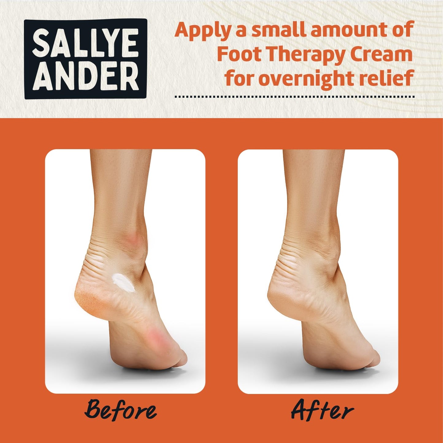 SALLYEANDER Heavy Duty Foot Therapy Cream - 2oz - Essential Oil Infused Healing Formula - Bold Tea Tree Oil, Mint, & Herbal Scent - Moisturize Dry Cracked Feet