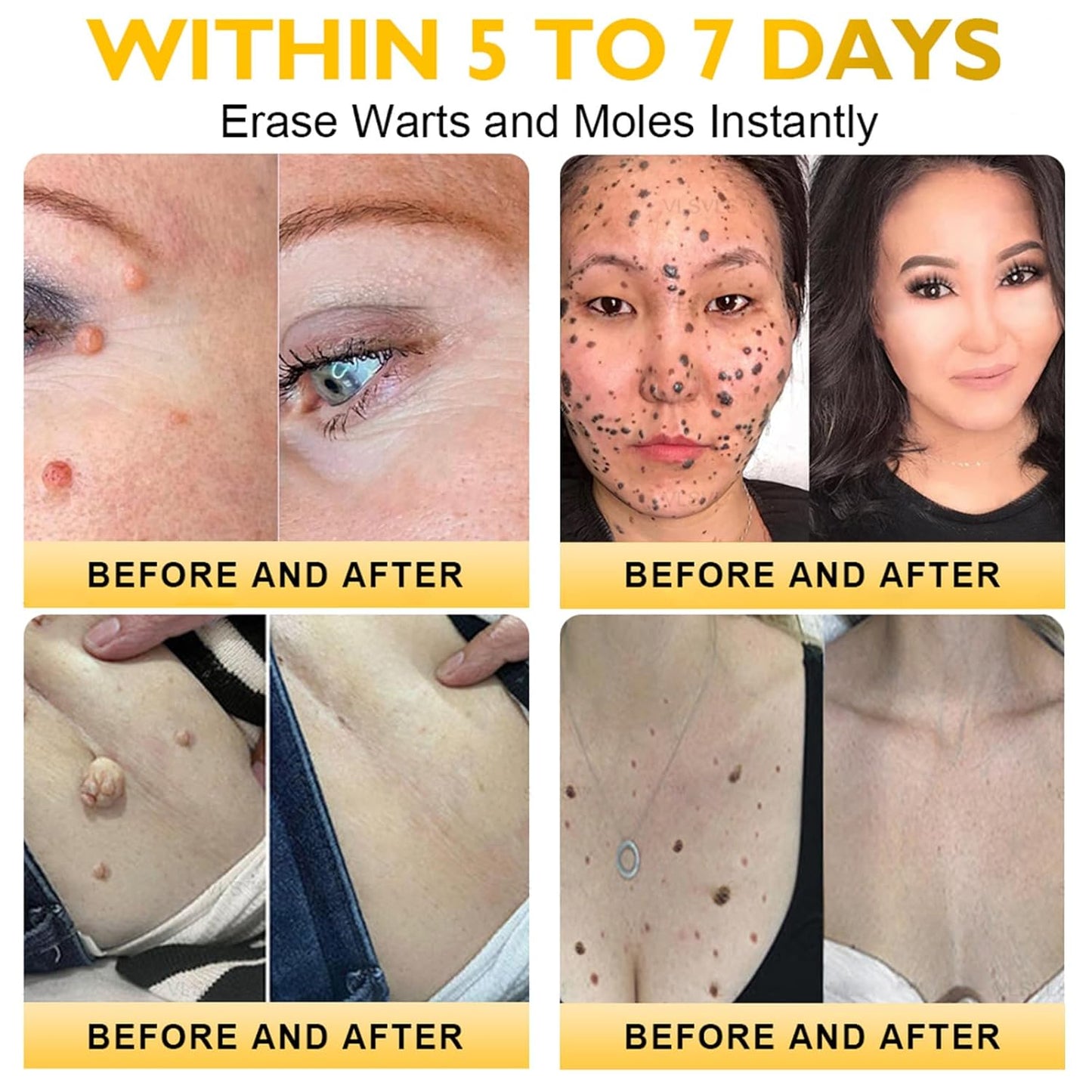 LipMaps Bee Venom skin Restoration Cream,Bee Venom Skin Treatment Cream,Deeply Moisturizing and Firming for All skin Types (1PC)