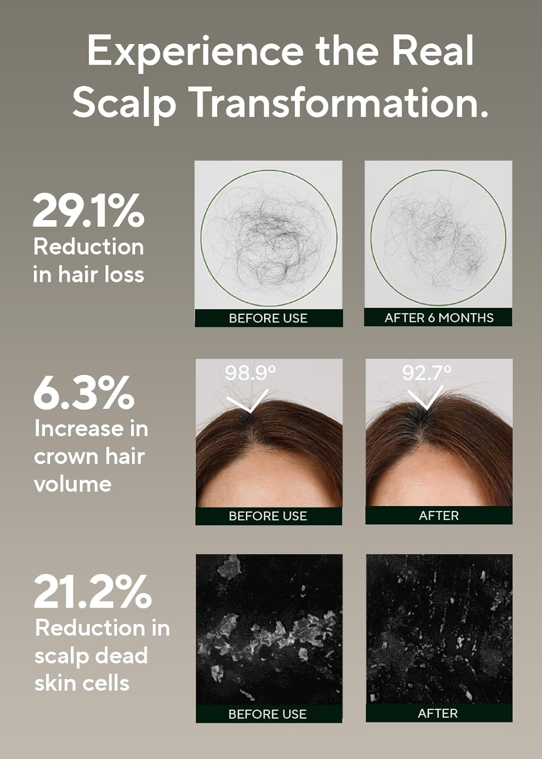 AROMATICA Rosemary Salt Scrub Shampoo - Hair Loss Korean Scalp Detox Shampoo with Rosemary Scalp Oil | Scalp Exfoliator with Salt Scrub for Oily Scalp | Sulfate Free, Silicone Free (10.5 oz / 300g)