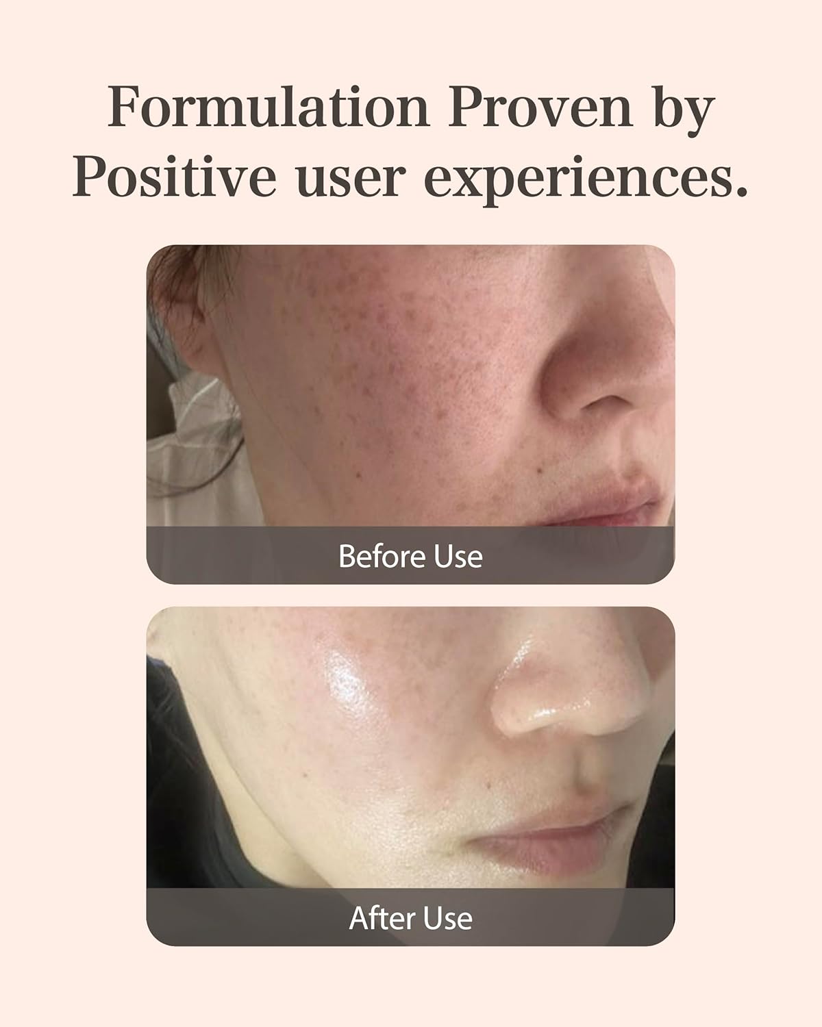 Mastina Mastic Ampoule - Facal Serum for Glass&Radiant Skin. White Mastic Complex 63% + Tranexamic Acid 2% + Niacinamide 5% Acid, Korean Skin Care (Dropper, 0.5fl oz)