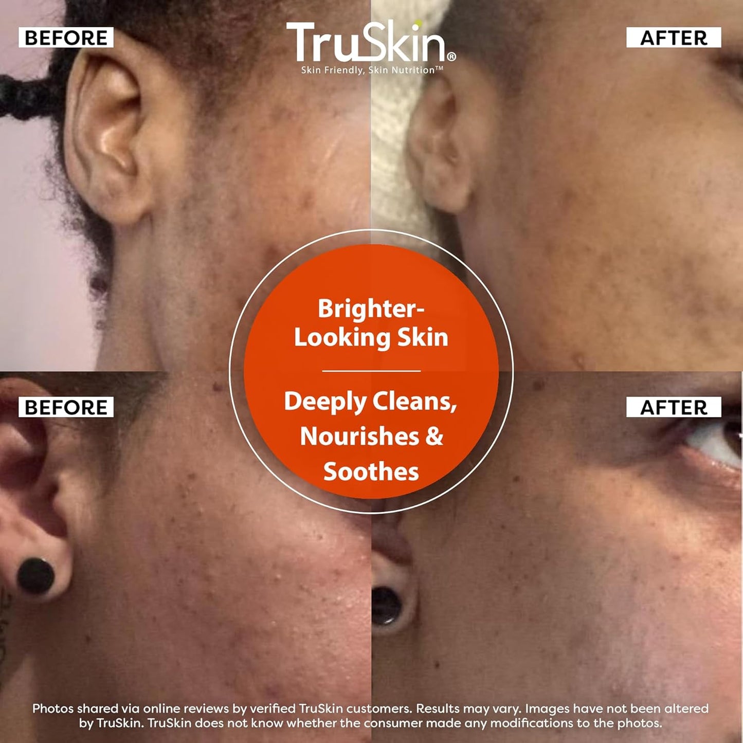 TruSkin Vitamin C Cleanser for Face - Brightening Face Wash with Vitamins C & E, Rosehip Oil, Aloe Vera and MSM - Deep Clean and Refresh for Radiant, Healthy-Looking Skin, 5 fl oz