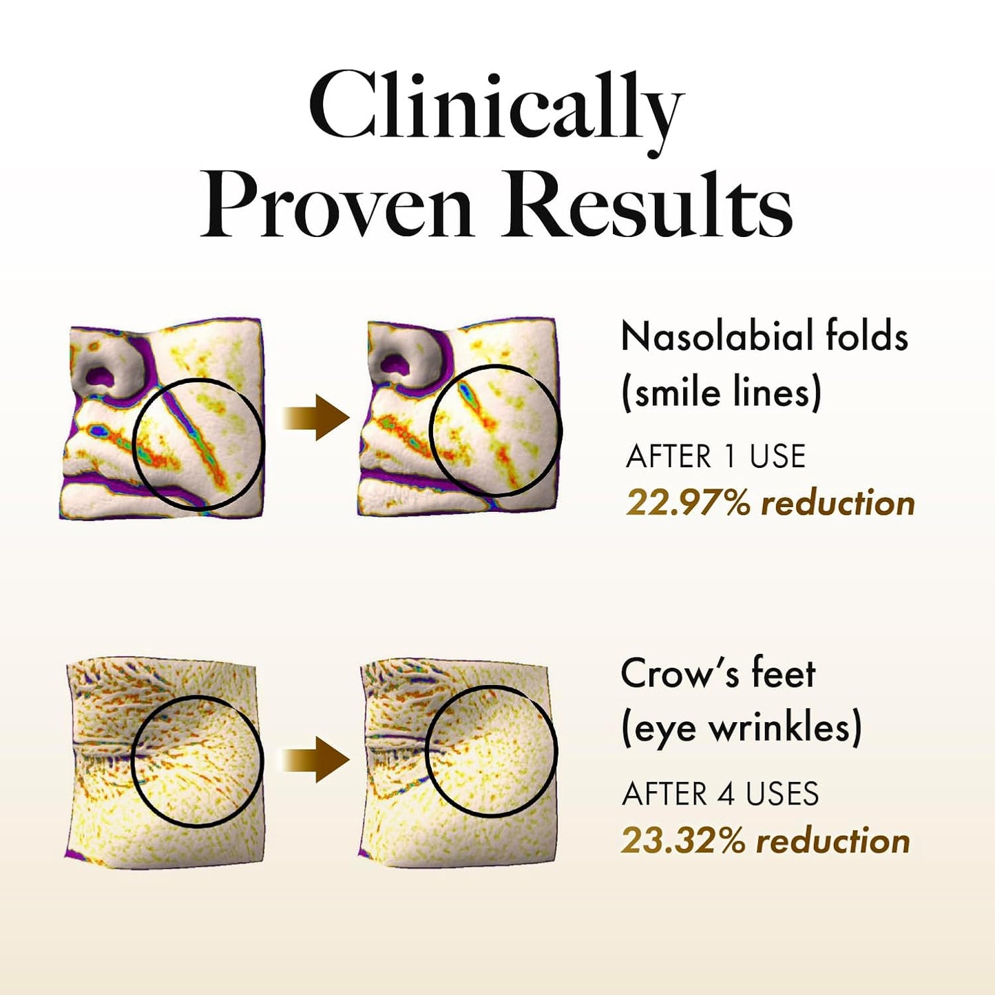 MASTINA Mastic Serum Roller - Dark Circle Remover & Eye Serum for Brighter, Firmer Under Eyes, Korean Skin Care, 0.5 fl oz,White Mastic Complex 63% + Tranexamic Acid 2% + Niacinamide 5%