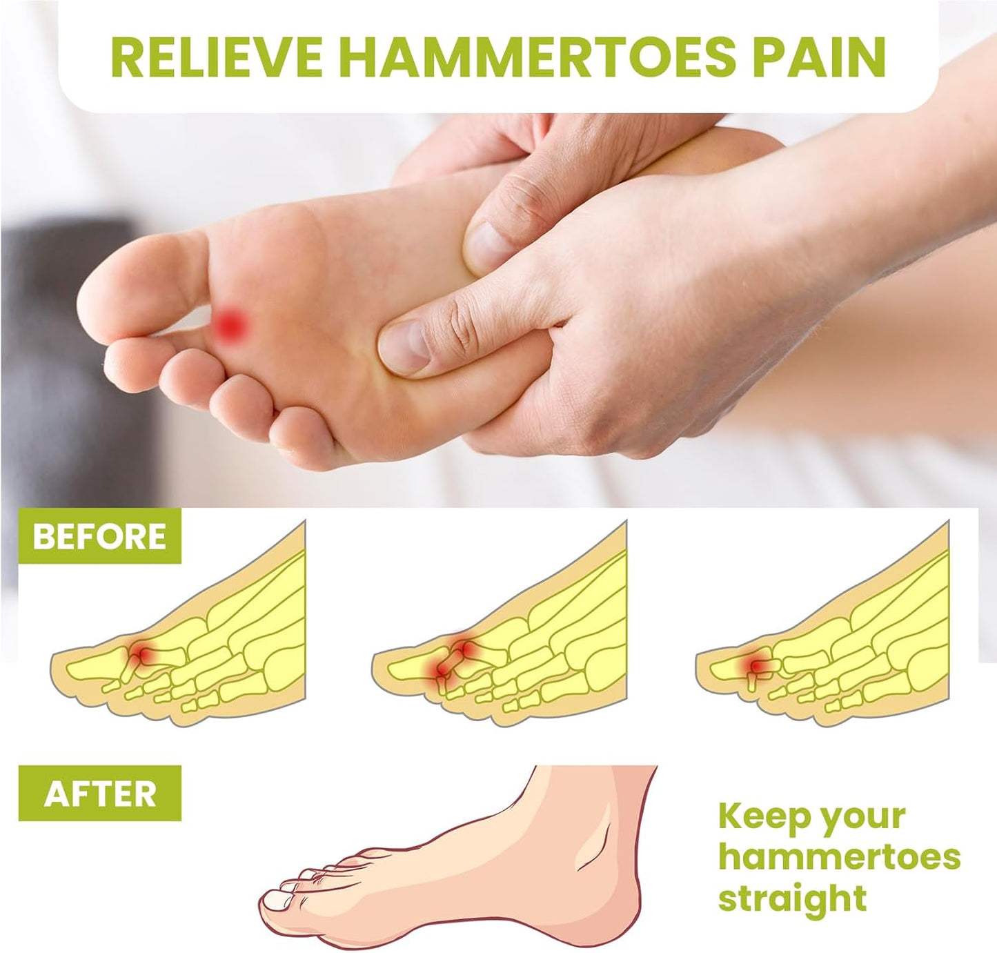 Bukihome Hammertoe Corrector Gel Toe Straighteners - 12 pcs Support Crest for Women & Men - Realign Bent, Crooked, Curled, Claw, Hammer Toes - White,Single Loop