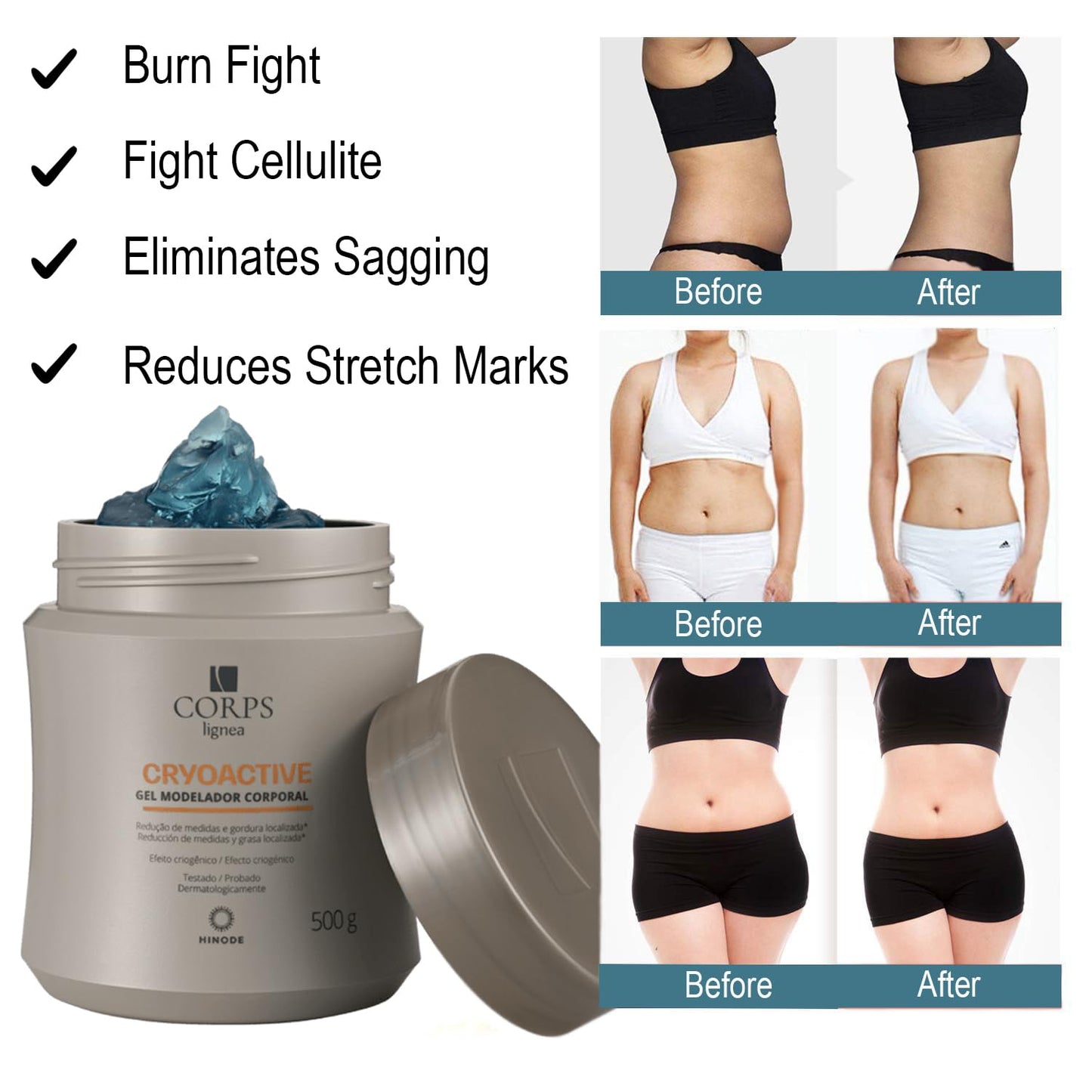CRYOACTIVE SLIM GEL, Body Contour Gel for Firmer Skin, Anti-cellulite for Men & Women, Tightening Gel for Tummy, HIPS and Buttocks