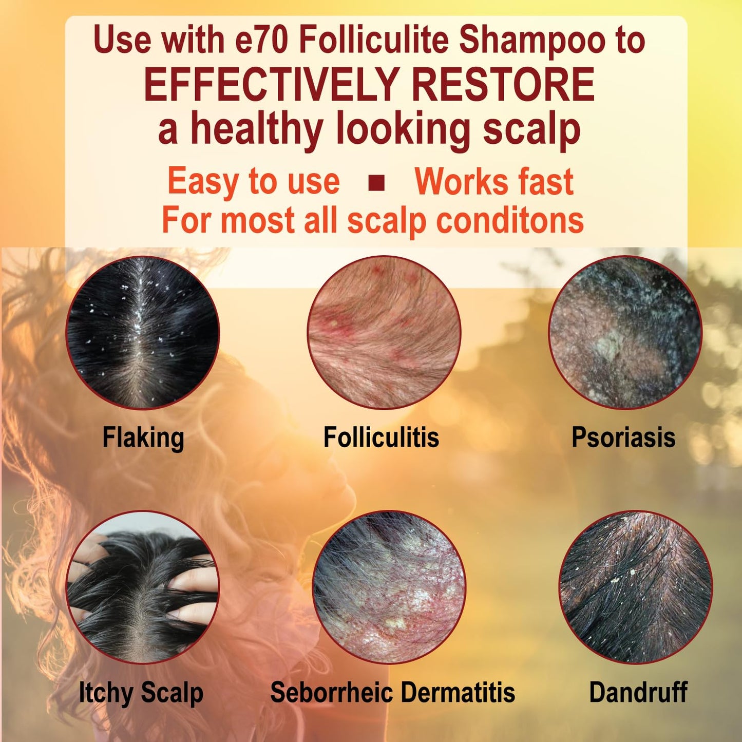 Folliculitis Treatment Conditioner with 3% BHA, Salicylic Acid, Tea Tree Oil & Chamomile Extracts - Anti Itch for women & men with Irritated Flaky Scalp Acne Treatment, Made in USA, 8 fl oz