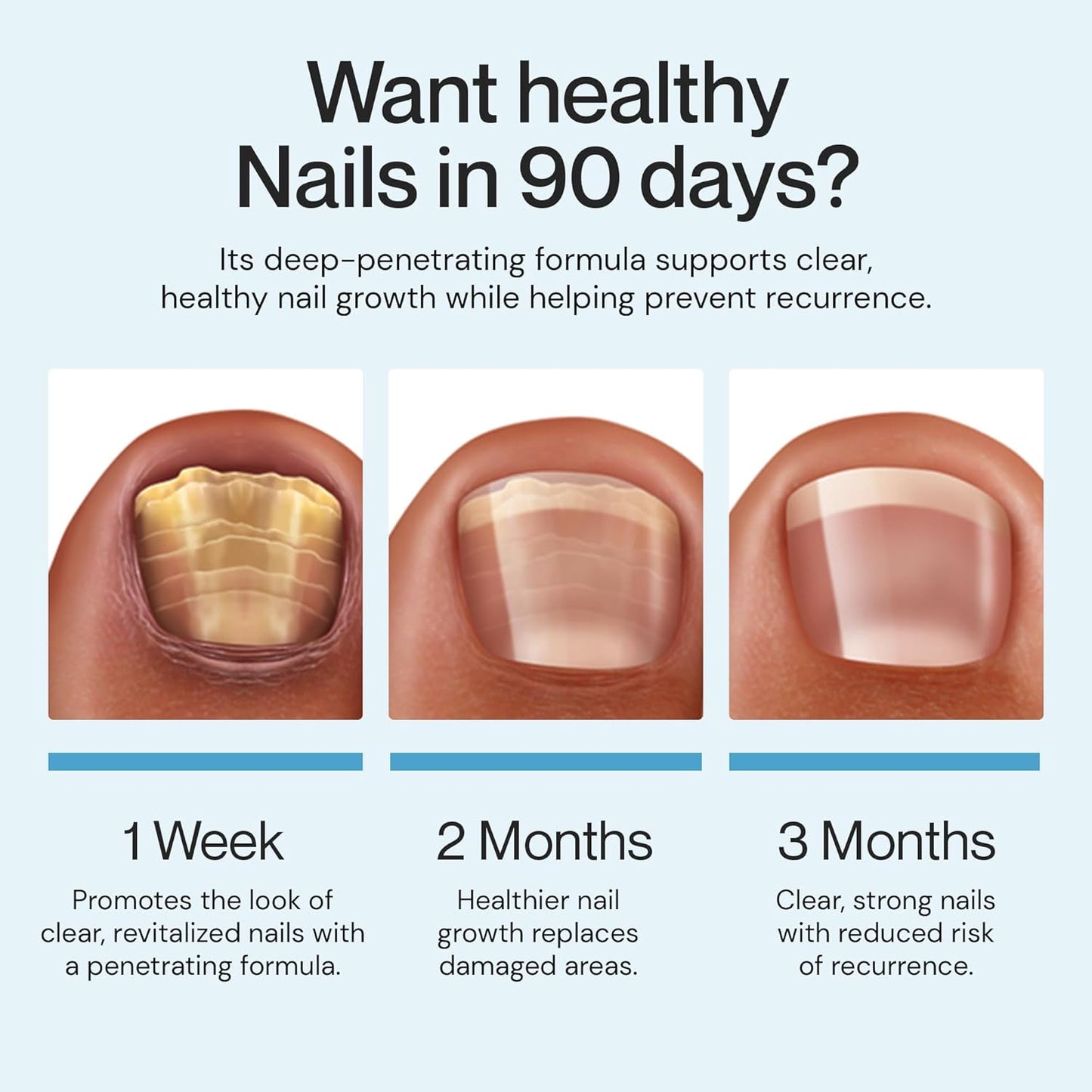 Nail Care/Conditioning Pen – Botanical Oils for Healthy, Clear-Looking Toenails and Fingernails – Fast Precision Brush Application Nail Repair Pen, Appearance of Clear Nails - Pack of 1