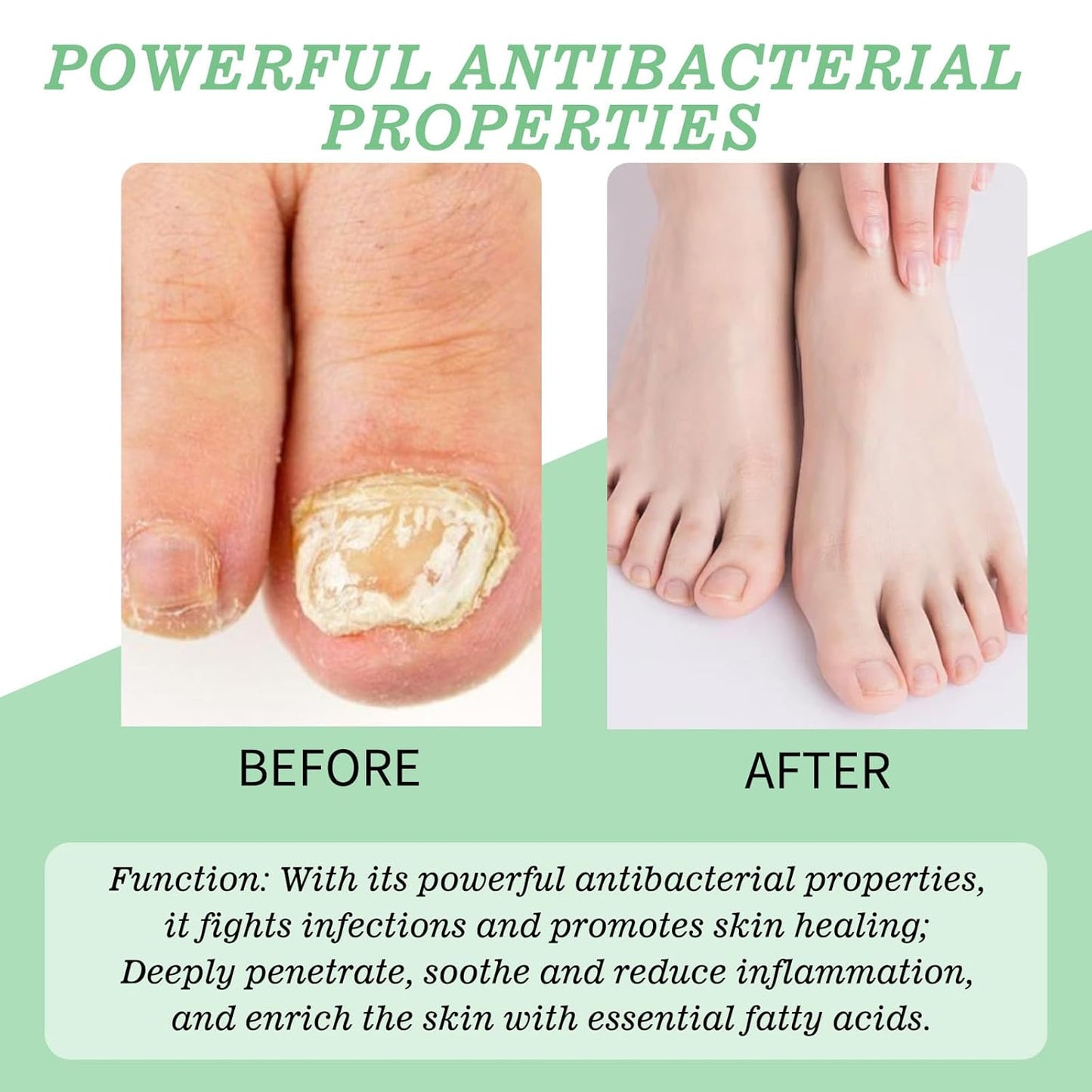 Nutraboost Nail Treatment, Nail Growth Serum for Repair & Strengthener,Multi-Purpose Nail Repair Oil Serum (2)