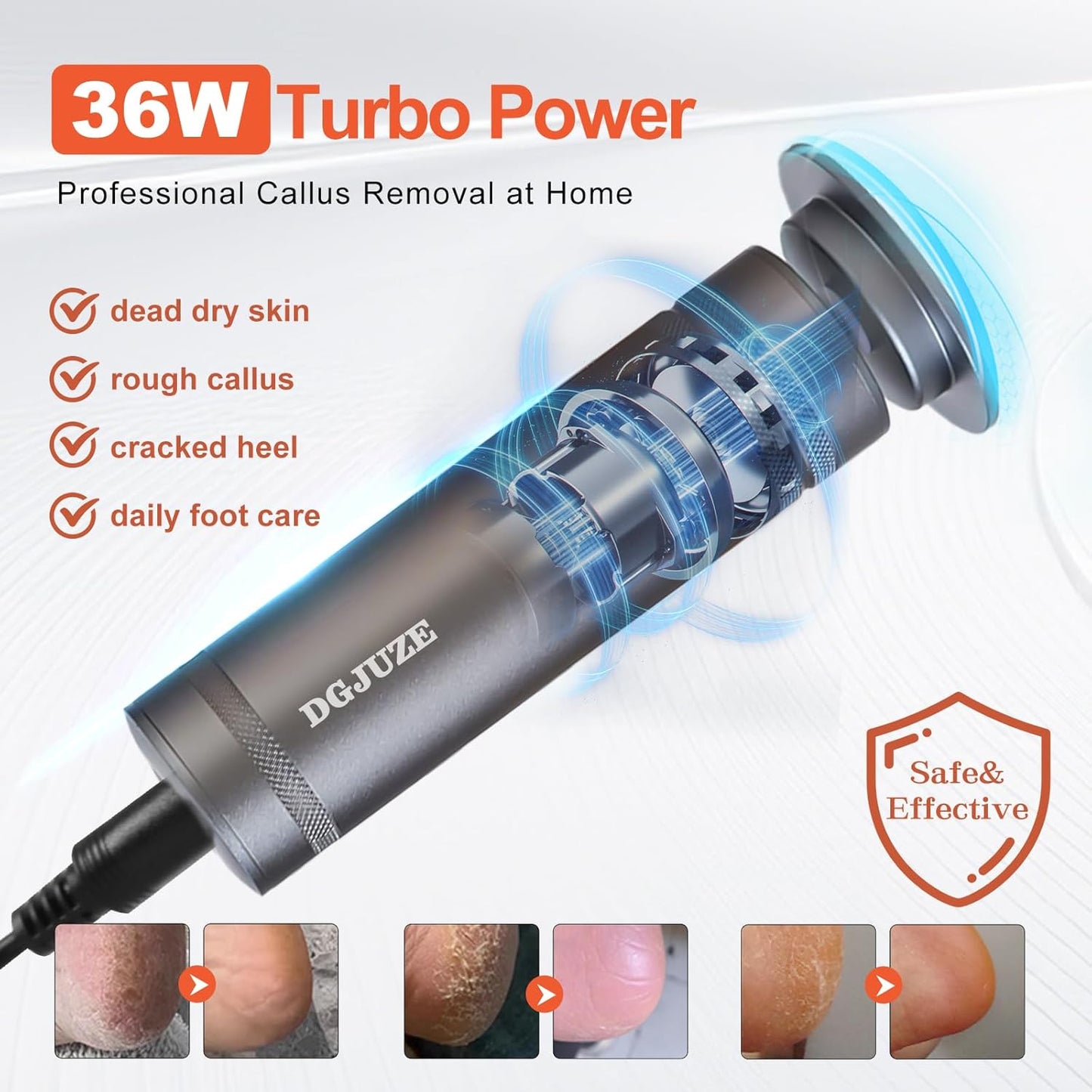 PowerPro Electric Foot Callus Remover,36W Professional 1200rpm Adjustable Speed Metal Body Heavy Duty Grinder for Dead Skin,Automatic Foot Sander with 60pcs Sandpaper Pads(Grey)