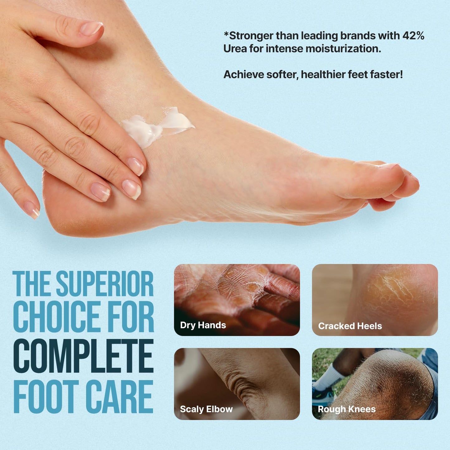 Urea Cream for Feet - Maximum Strength 42% Foot Cream for Calluses and Dry Feet - Free Pumice Stone and Brush - Shea and Mango Butters-Paraben Free-Fragrance Free- 4oz.
