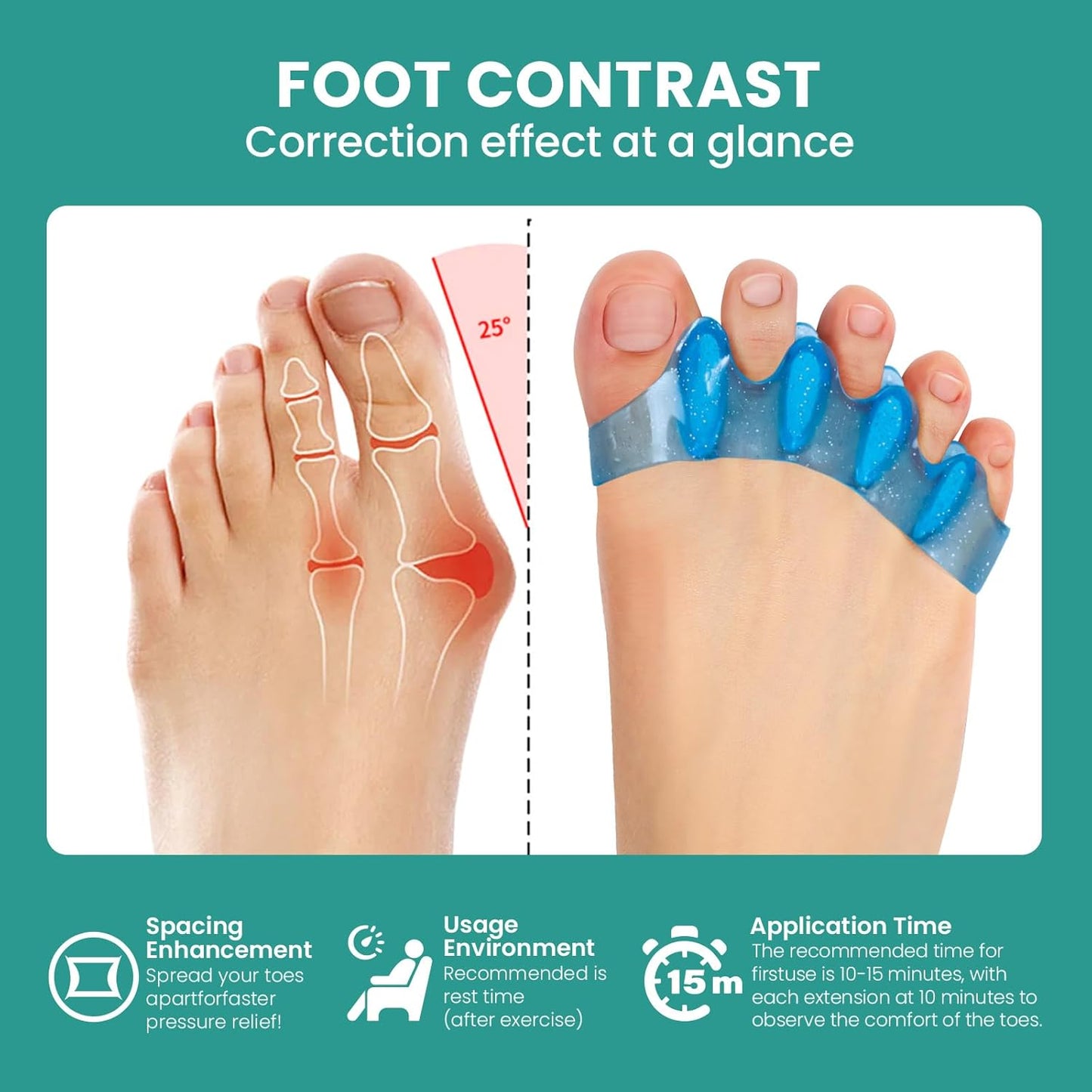 Welnove Toe Separators & Toe Spacers: Bunion Corrector for Women Men, Toe Spacers Toe Stretcher for Nighttime, Yoga Practice (8Pcs, Blue)