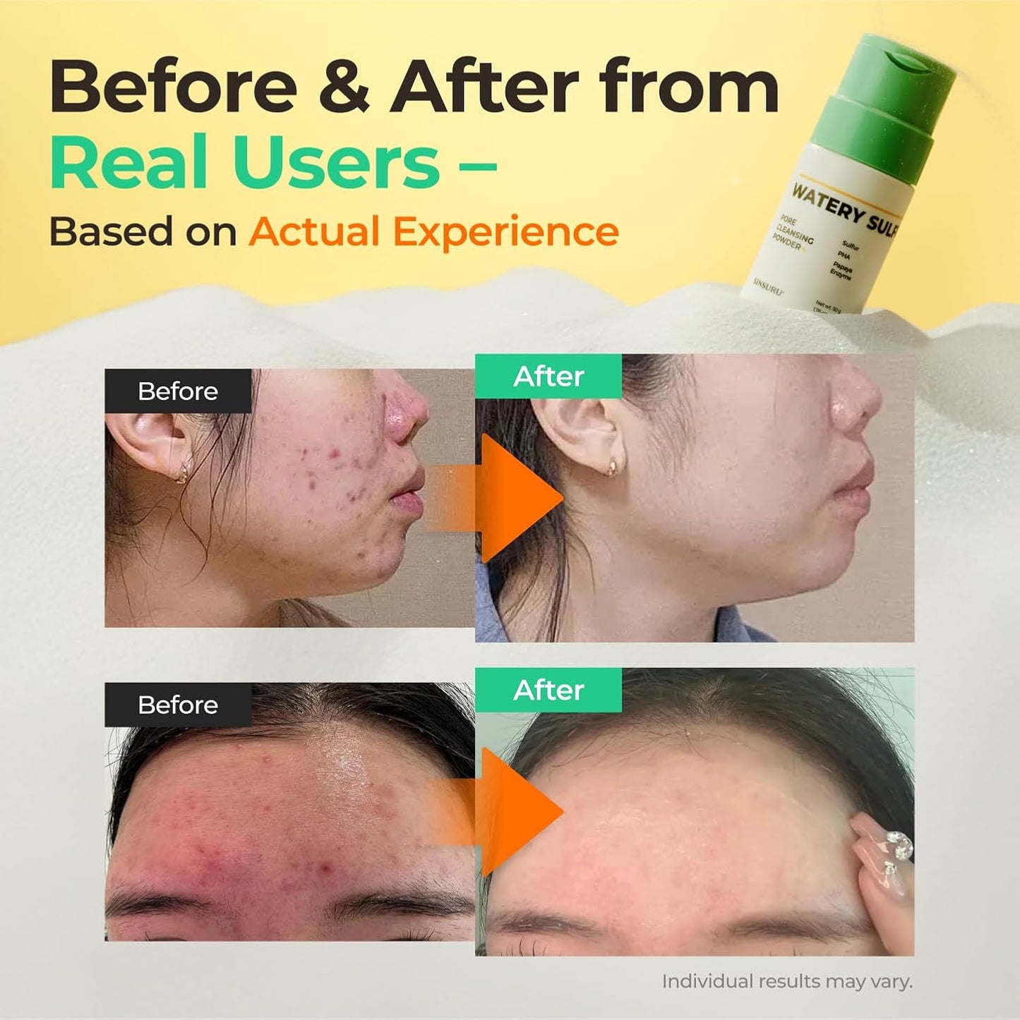 Watery Sulfur Pore Cleansing Powder, Korean Enzyme & Rice Powder & PHA Face Wash for Blackhead Removal, Sensitive and Acne-Prone Skin, Radiant Glow, Bumpy skin (1.76 oz / 50g)