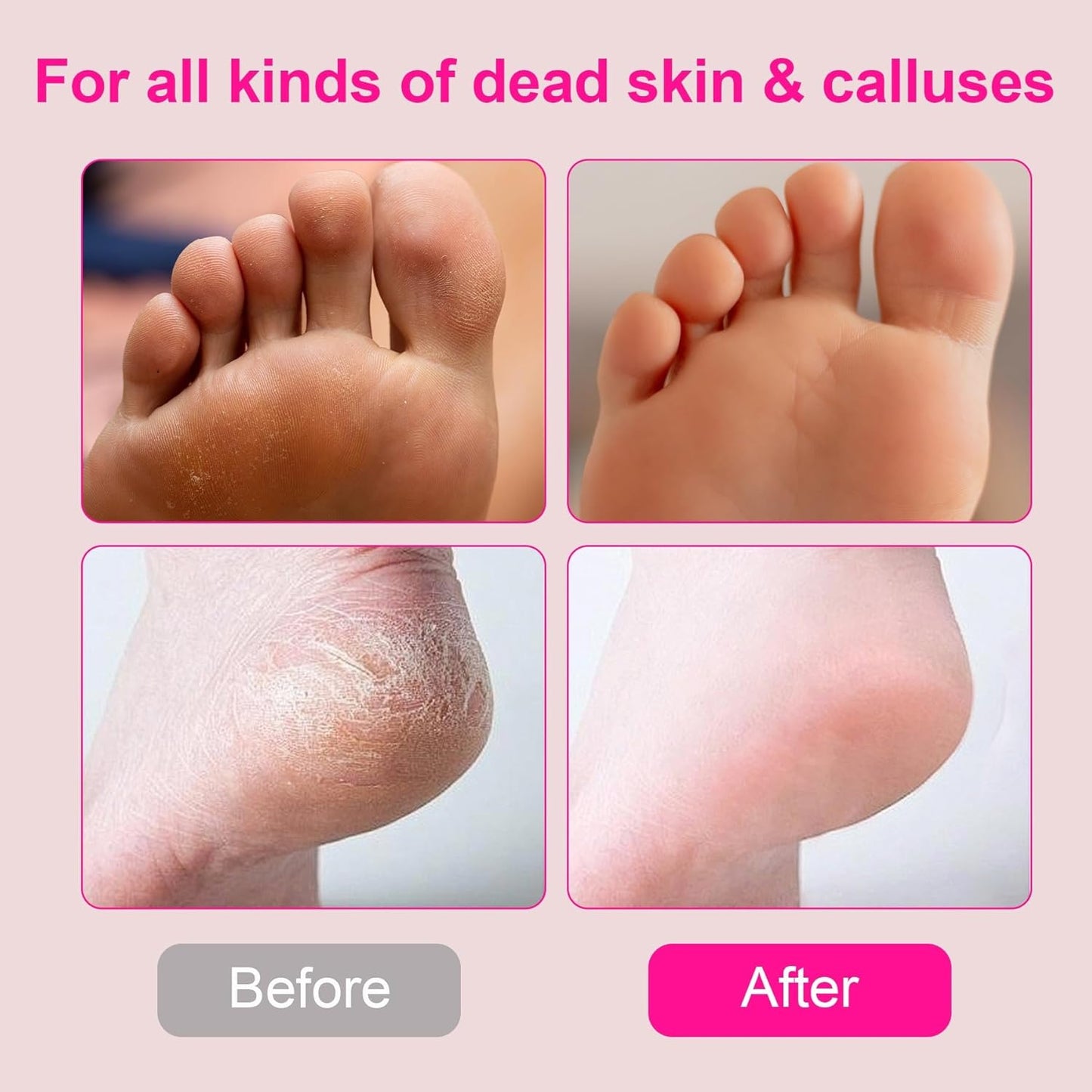 Electric Foot Callus Remover with 60 Pcs Sandpaper Discs, Adjustable Speed Electric Foot File Grinder, Professional Pedicure Tool for Dead Skin & Cracked Heel