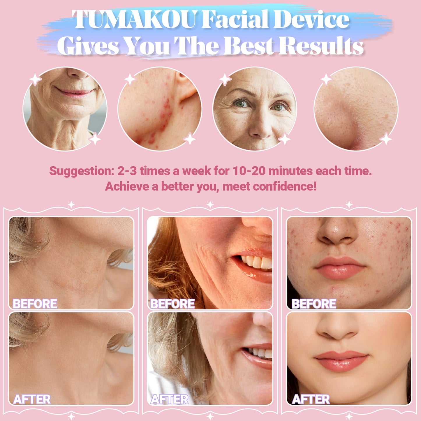 High Frequency Facial Machine - TUMAKOU Portable Handheld High Frequency Wand with 6 Pcs Violet Tubes for Face Home Use Device