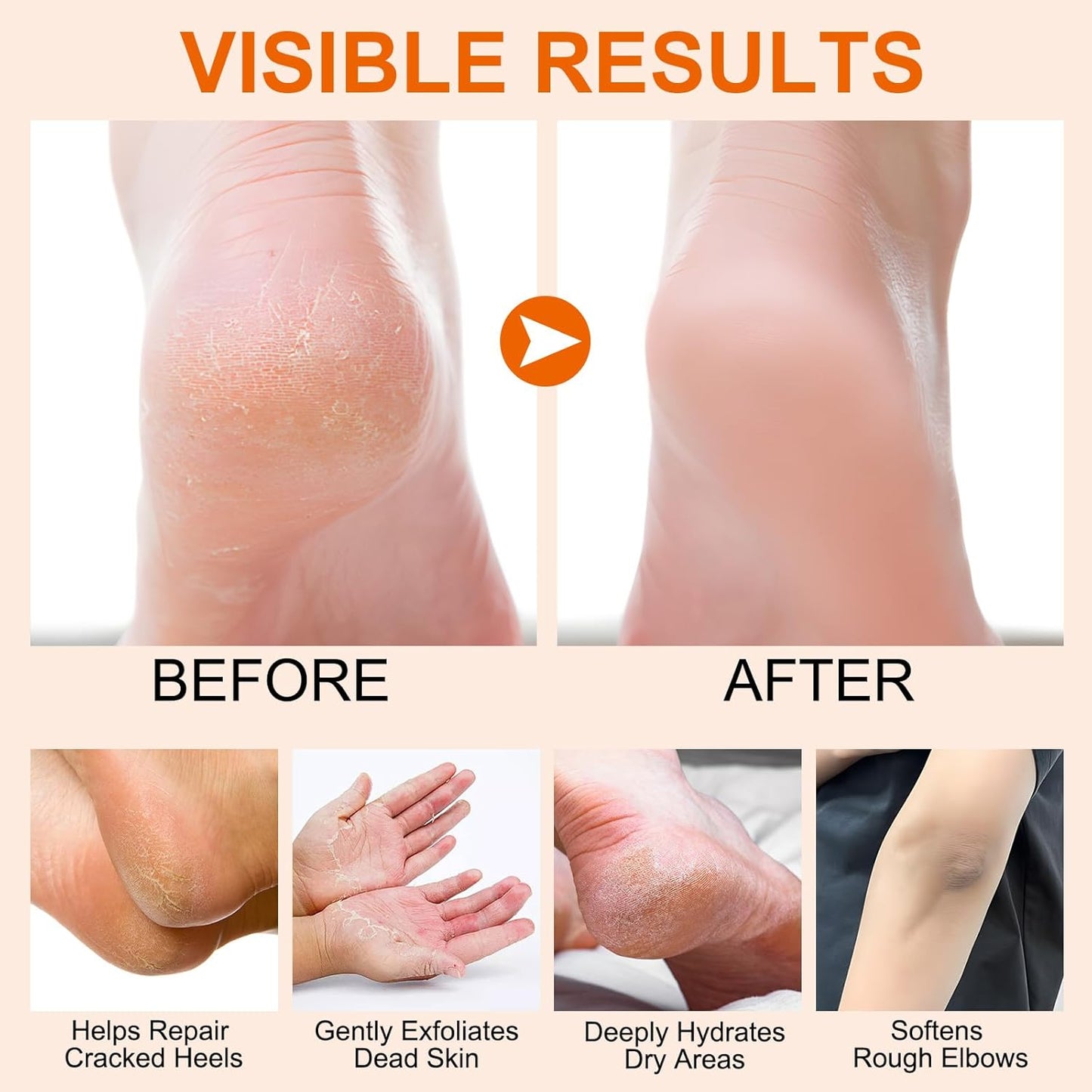 60% Urea Cream, Manuka Honey Hand Foot Moisturizer Cream for Dry Cracked Heels, Foot Care Stick for Softening and Moisturizing Skin, Deep Hydration, 1.41Fl Oz