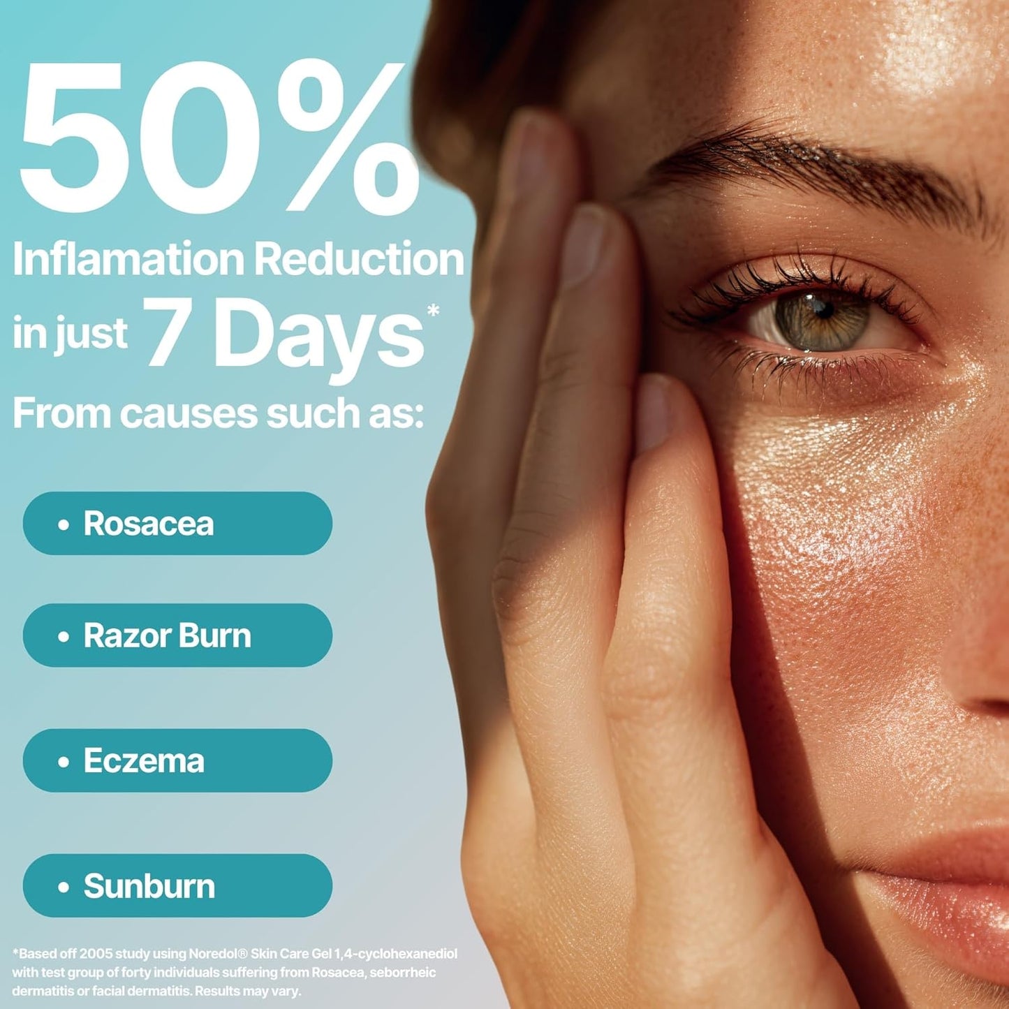 Skin Care Gel - Redness Relief Moisturizer for Dry Skin - Rosacea Treatment for Face - Soothes Prone Skin and Irritation - Fragrance Free 1 oz