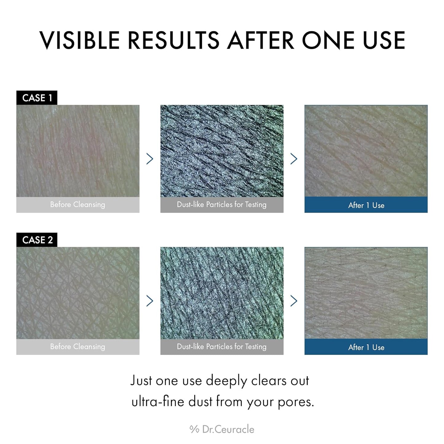 Dr.Ceuracle Pro Balance Enzyme Powder Face Wash - Korean Day and Night Natural Enzyme Powder Face Wash for Deep Pore Cleansing, Sebum Removing, pH Skin Balancing Care (Night Wash)