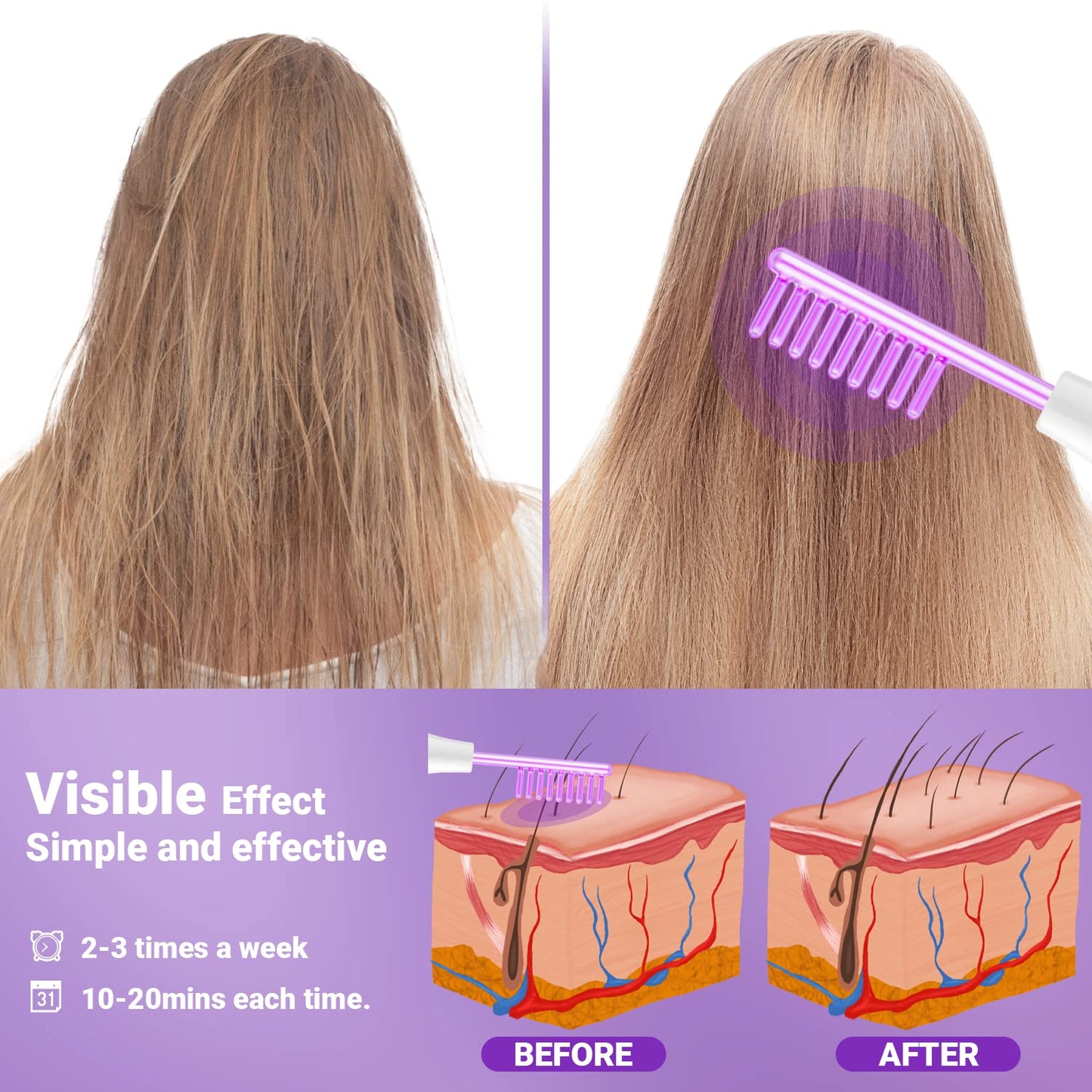 High Frequency Facial Wand-UUPAS Portable Handheld High Frequency Facial Machine Skin Facial Wand with 4 Violet Tubes