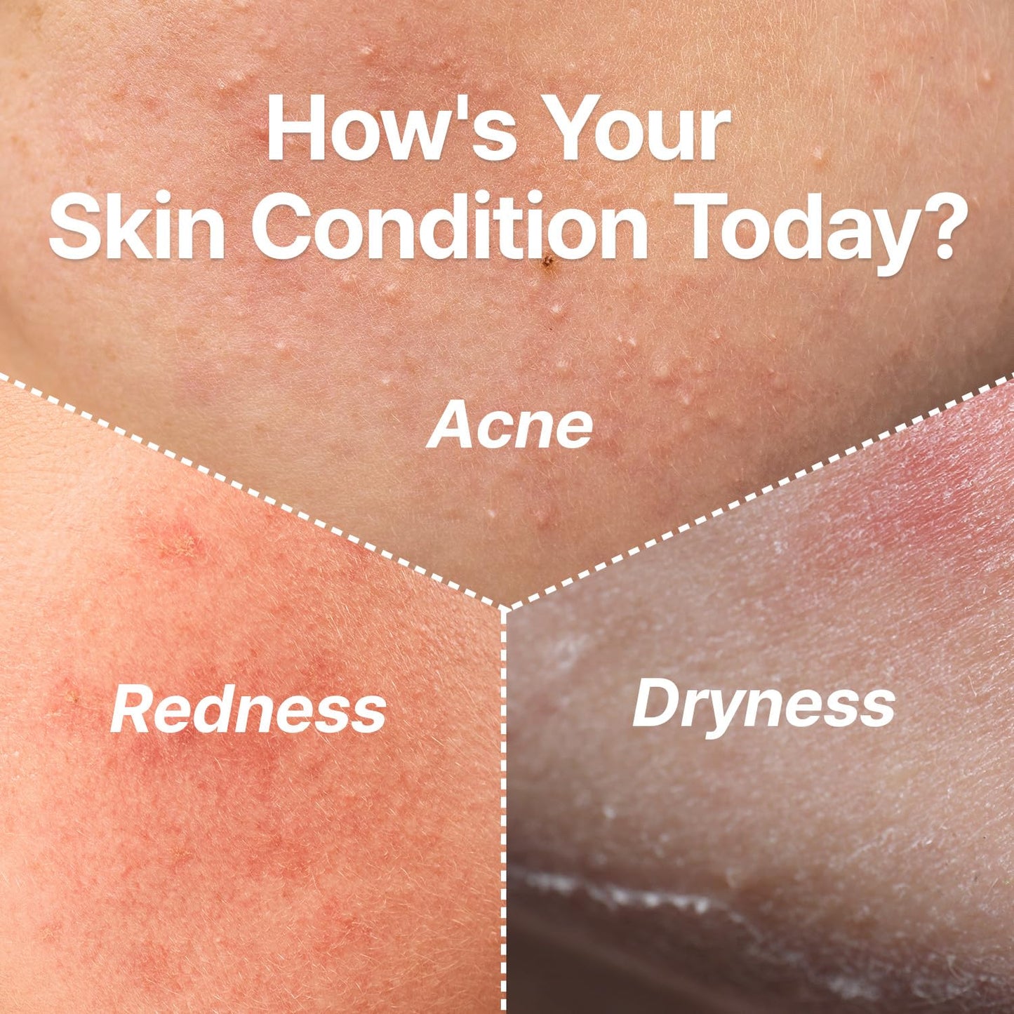 Green Barley Light Cleansing Oil, Hydrating Daily Cleanser for Sensitive Skin, Blackhead Remover, Korean Vegan Skin Care, 6.93 Fl Oz